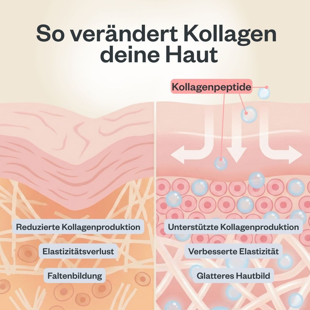 Diagramm zeigt die Wirkung von Kollagen auf die Haut. Text: Reduzierte Kollagenproduktion, Elastizitätsverlust, Faltenbildung.