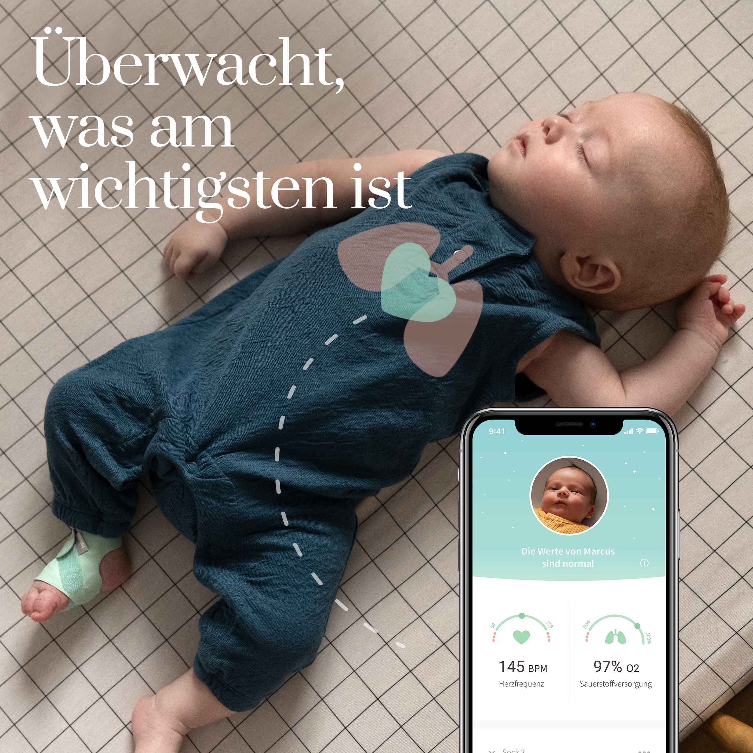 Owlet Smart Sock