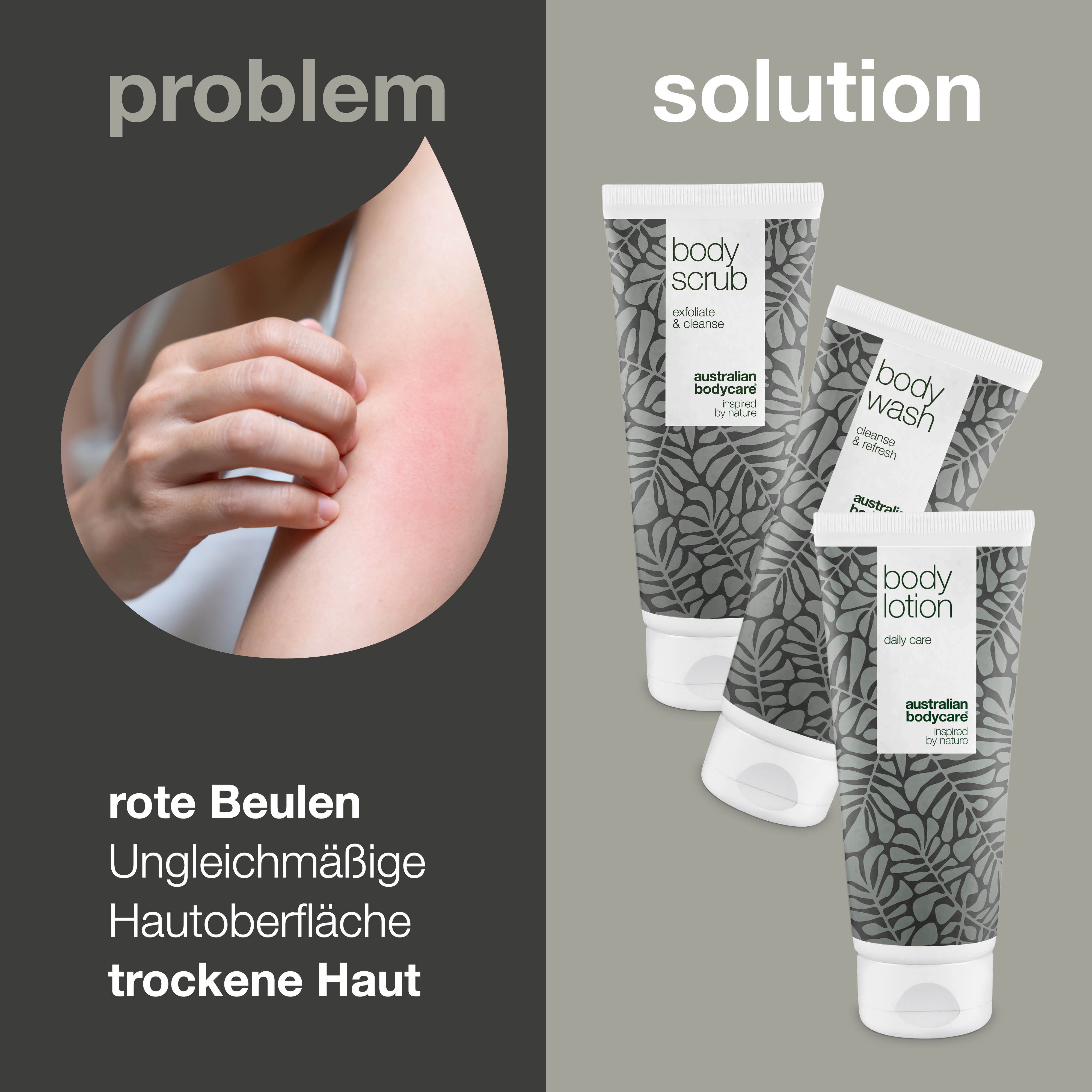 Problem: Rote Beulen, ungleichmäßige Haut, trockene Haut. Lösung: Drei Tuben. Aufschrift: Body Scrub, Body Wash, Body Lotion.