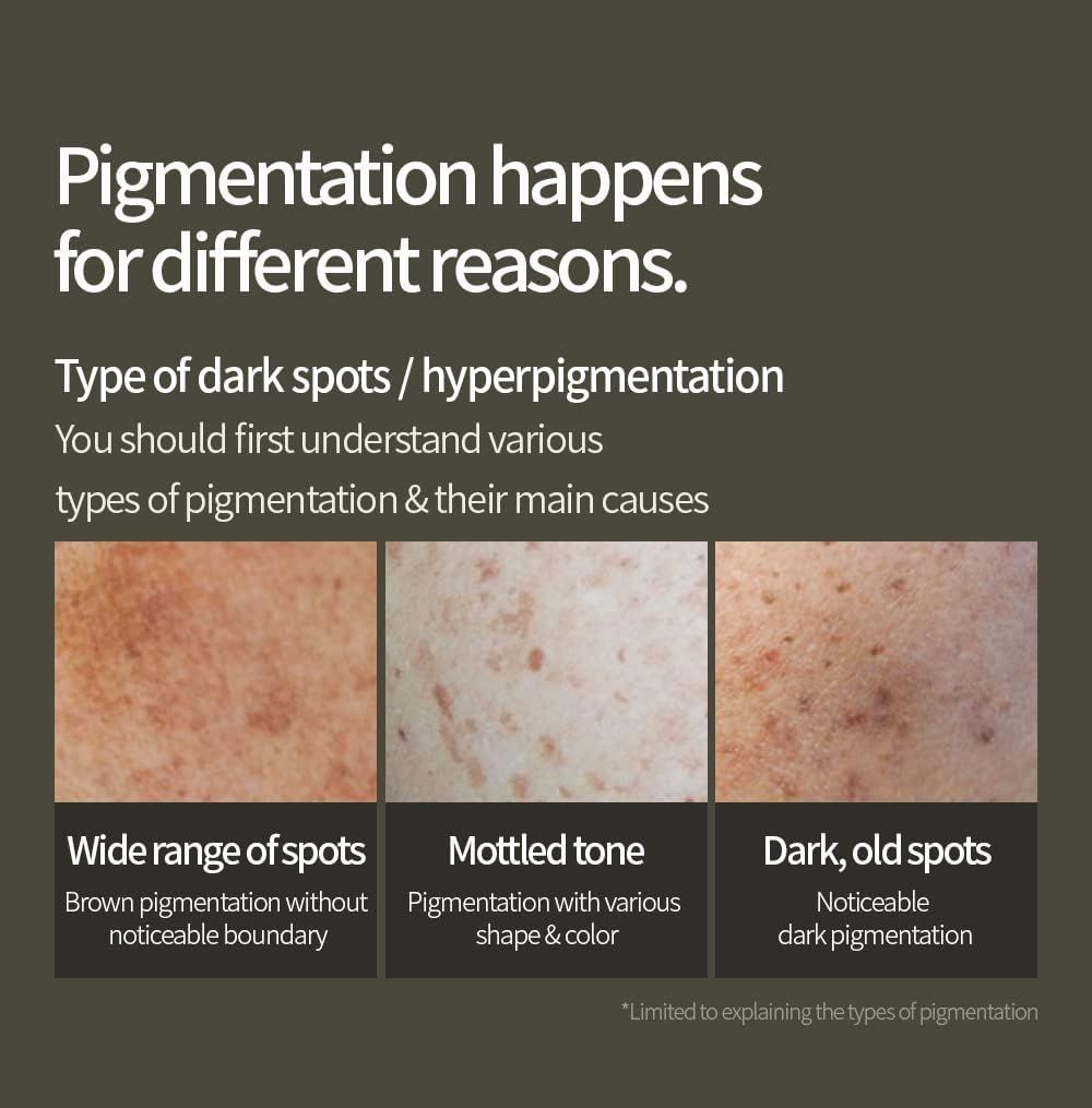 Drei Hautbilder zeigen verschiedene Arten von Pigmentierung: breite Flecken, gesprenkelter Ton und dunkle, alte Flecken.