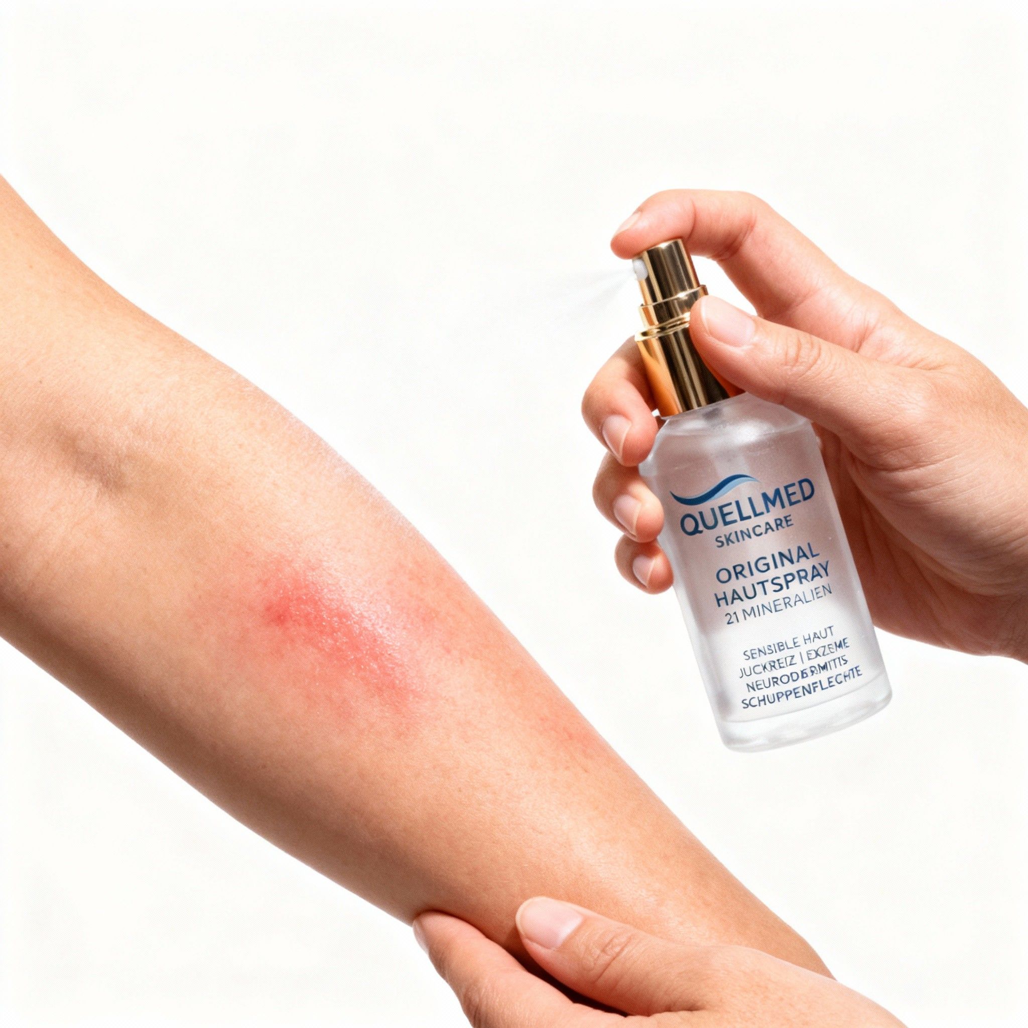 Person sprüht Produkt auf Arm mit Hautrötung. Flasche mit Aufschrift: Original Hautspray, 21 Mineralien.