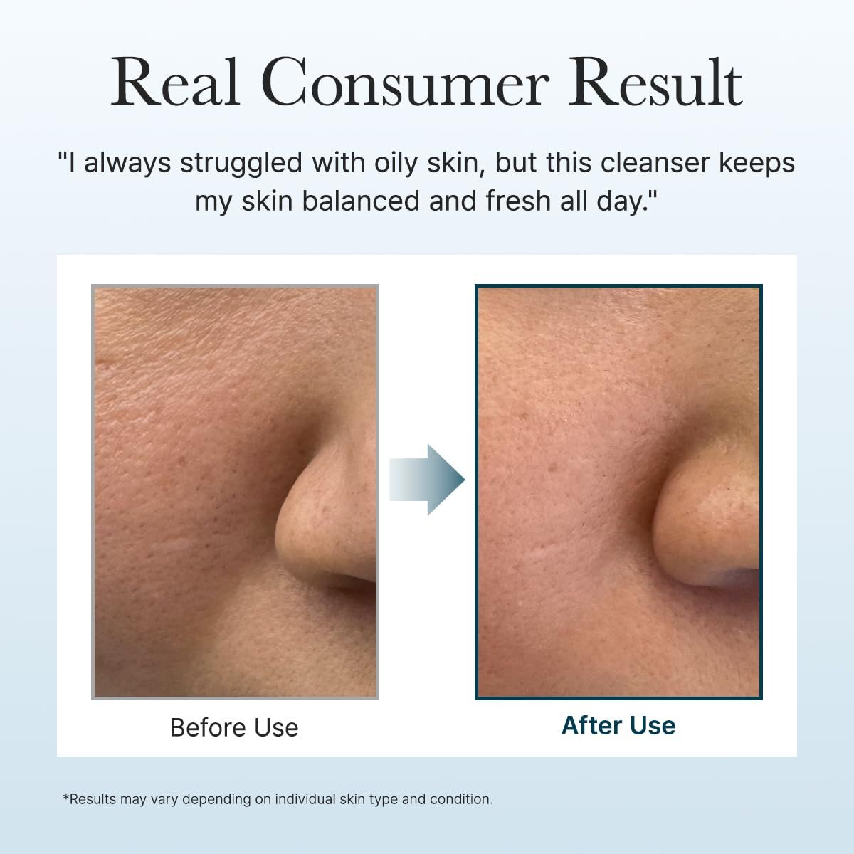 Vorher-Nachher-Bild. Zeigt Haut vor und nach der Anwendung des Reinigers. Text: Real Consumer Result.
