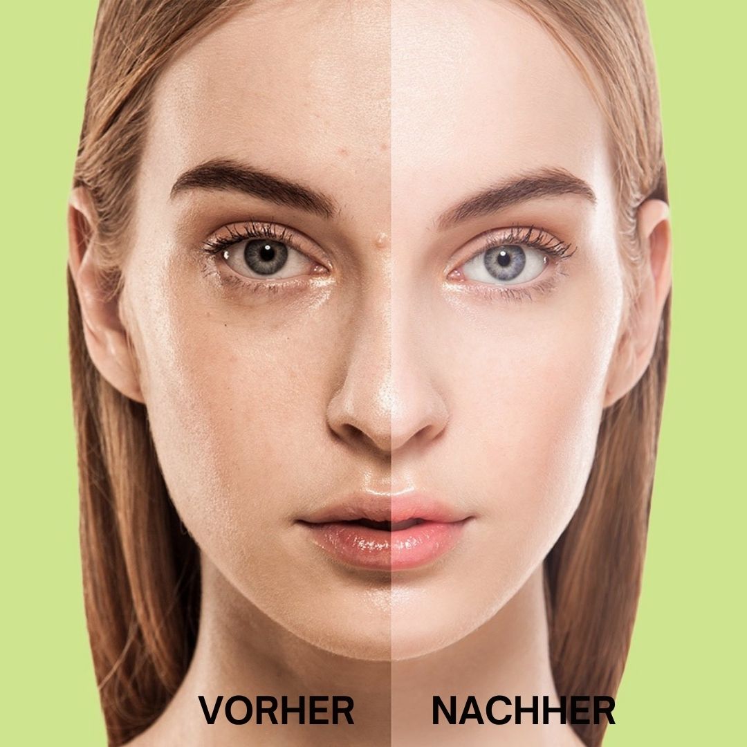 Gesicht einer Frau, geteilt in Vorher und Nachher. Deutliche Unterschiede im Hautbild.