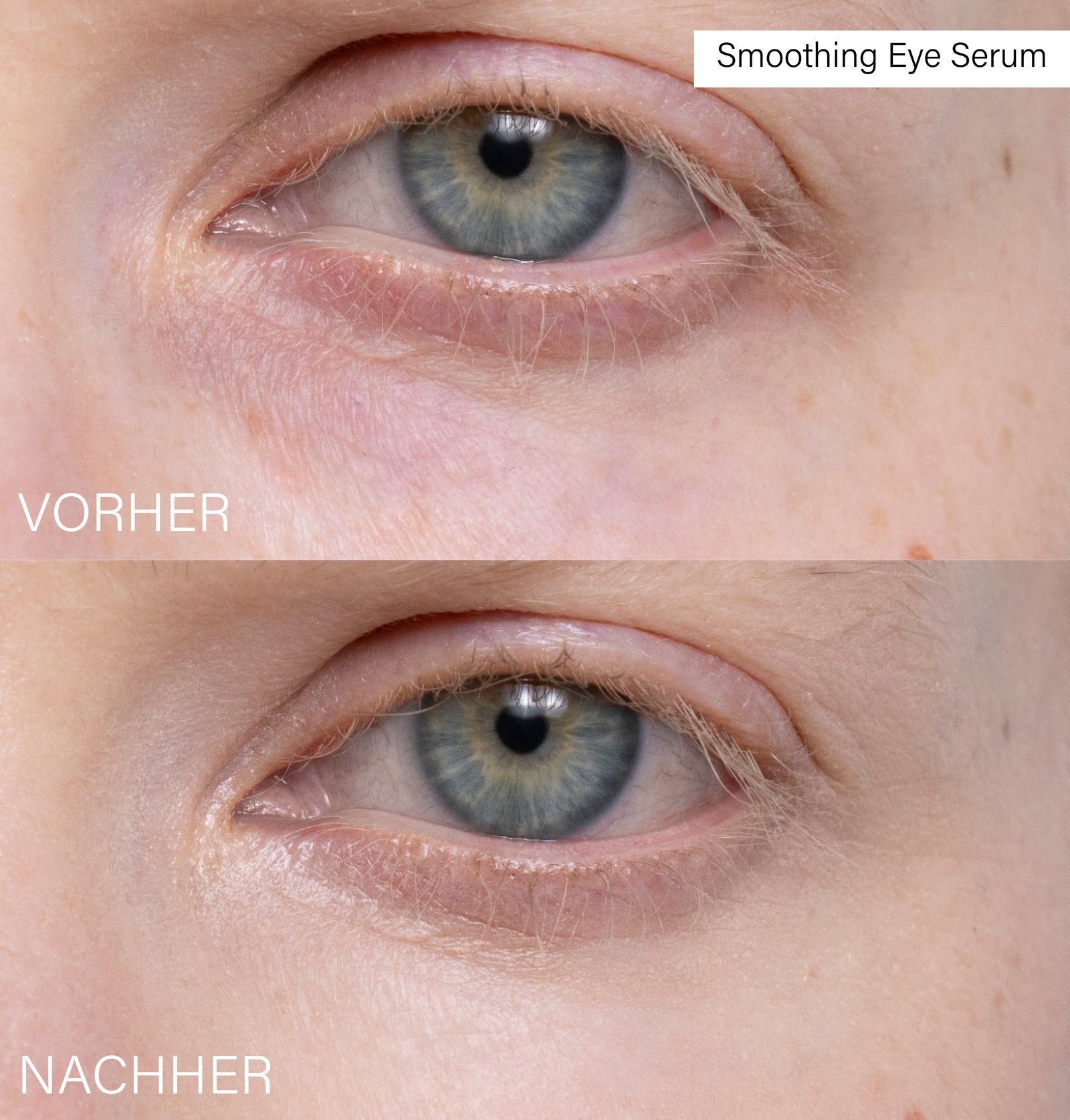 Vergleich von Augenpartien: Vorher und Nachher. Text: Smoothing Eye Serum.