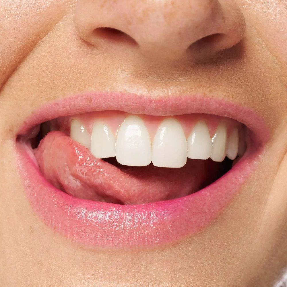 Nahaufnahme eines Mundes mit rosa Lippen und Zähnen. Die Zunge ist teilweise sichtbar.