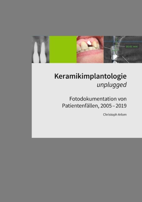 Keramikimplantologie unplugged