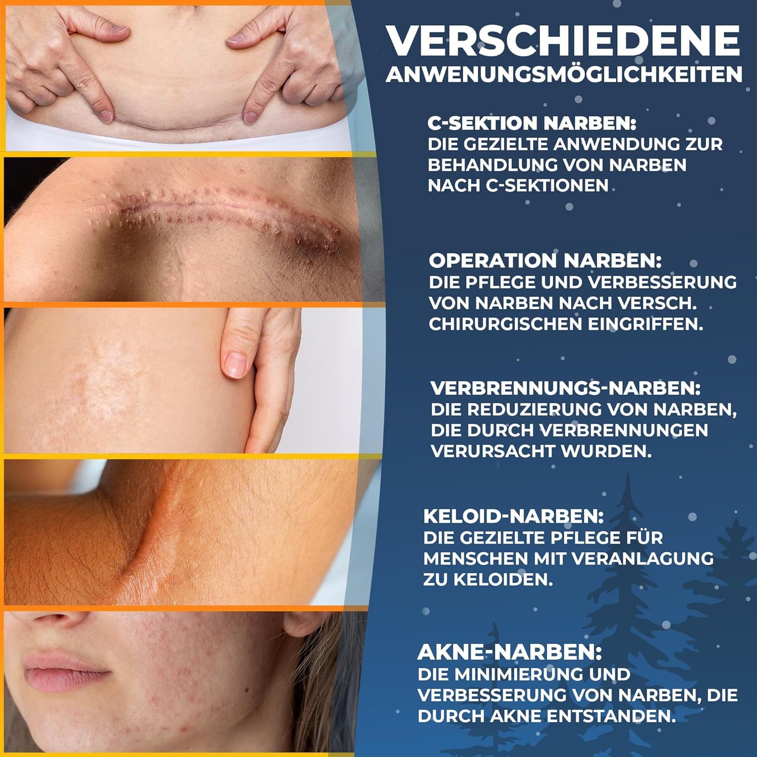 Grafik zeigt verschiedene Narbenarten und Anwendungsbereiche: C-Sektion, Operation, Verbrennung, Keloid, Akne. Text: Verschiedene Anwendungsmöglichkeiten.