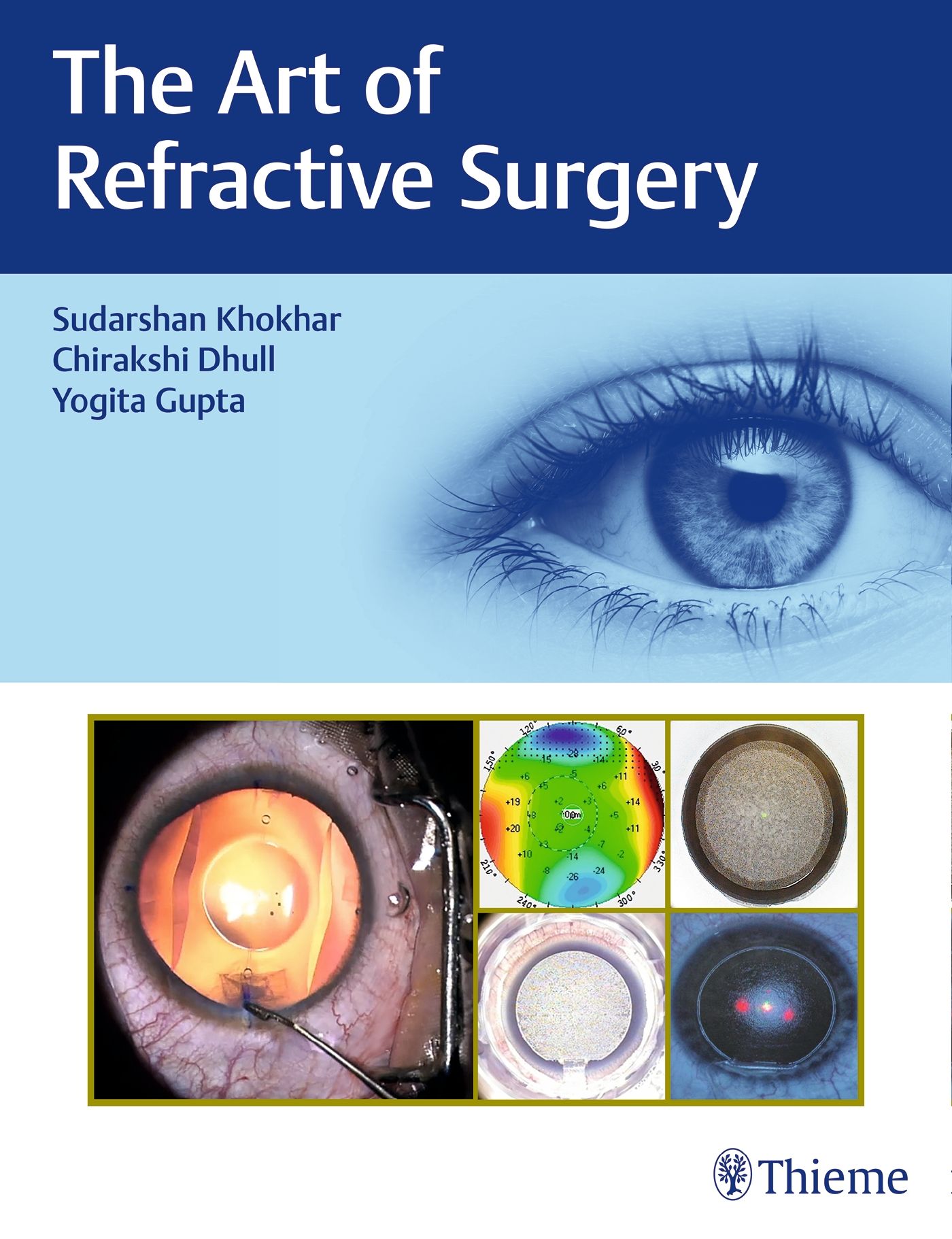 Buchcover: "The Art of Refractive Surgery". Autoren: Sudarshan Khokhar, Chirakshi Dhull, Yogita Gupta. Abbildung eines Auges und medizinischer Bilder.