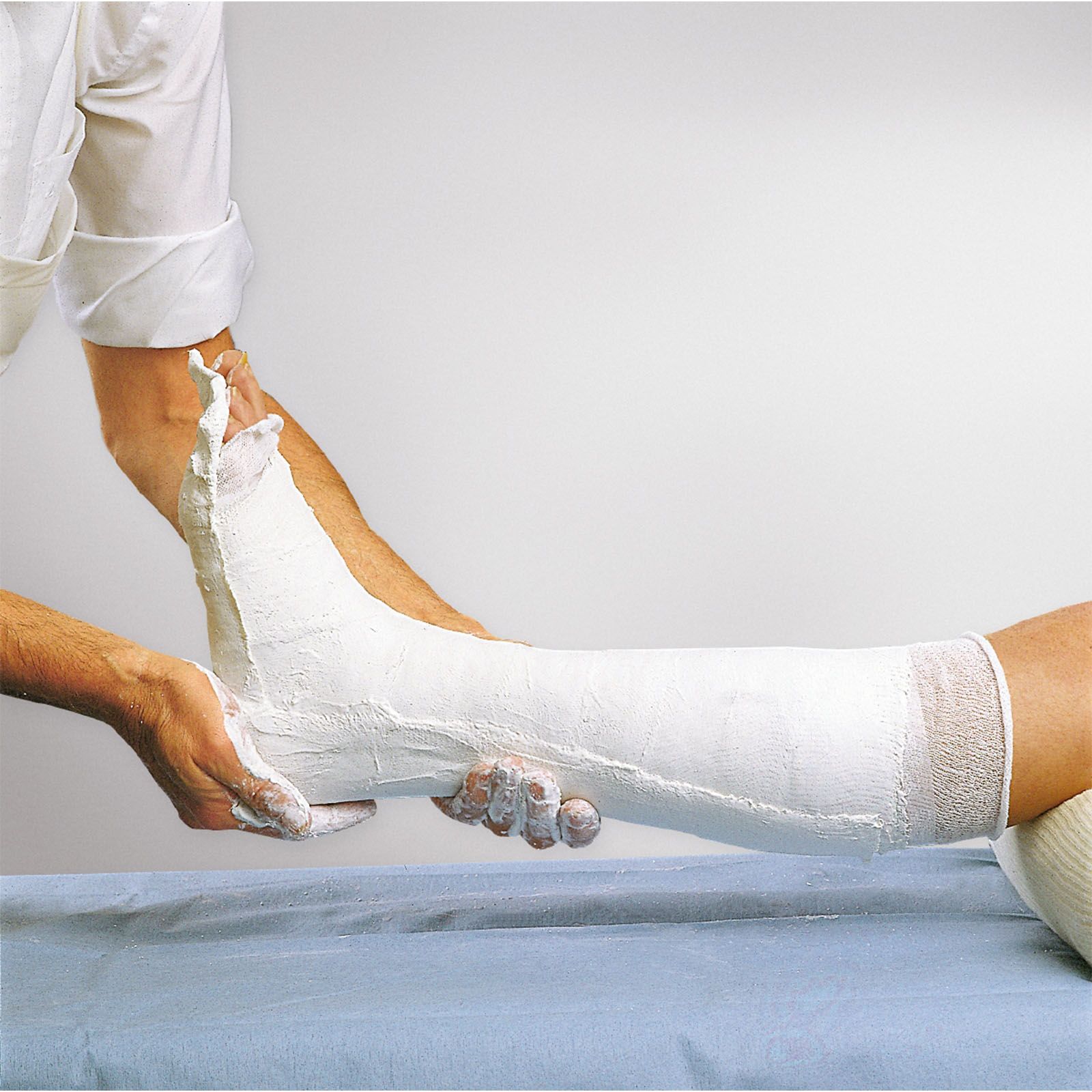 Cellona® Gipslonguette – zur Ruhigstellung und Schienenversorgun