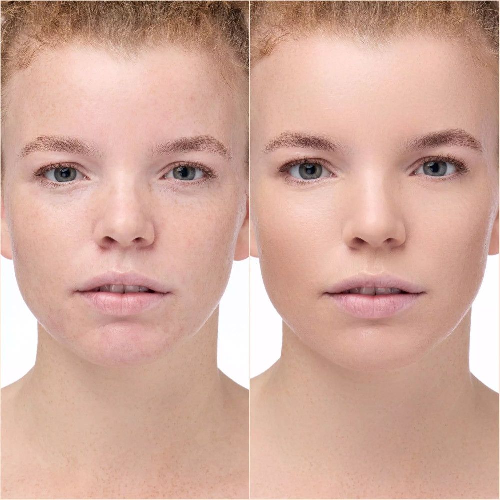 Vorher-Nachher-Vergleich. Gesicht mit und ohne Concealer. Hautton verbessert.