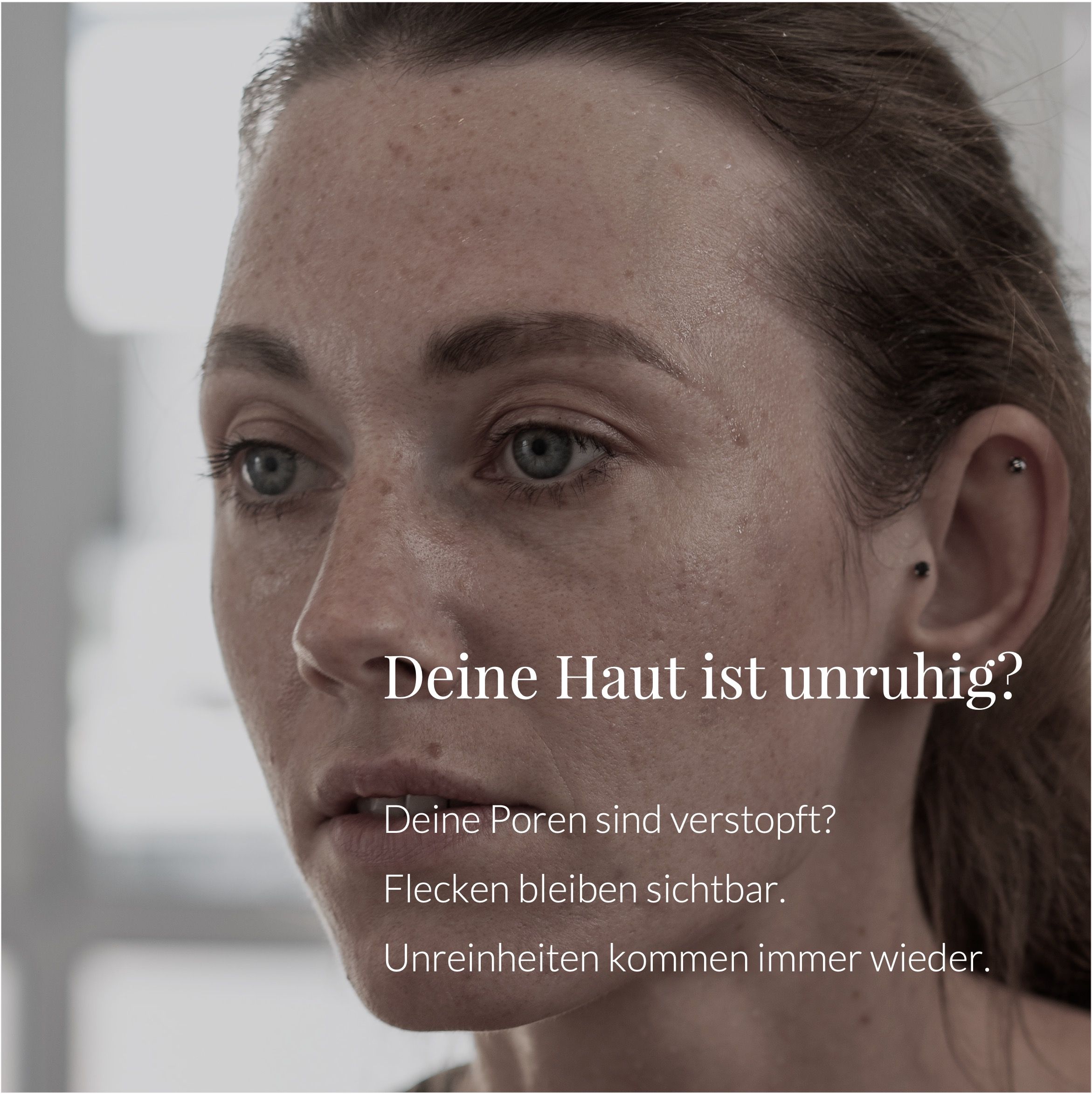 Frau mit Hautunreinheiten. Text: Deine Haut ist unruhig? Text über Hautprobleme.
