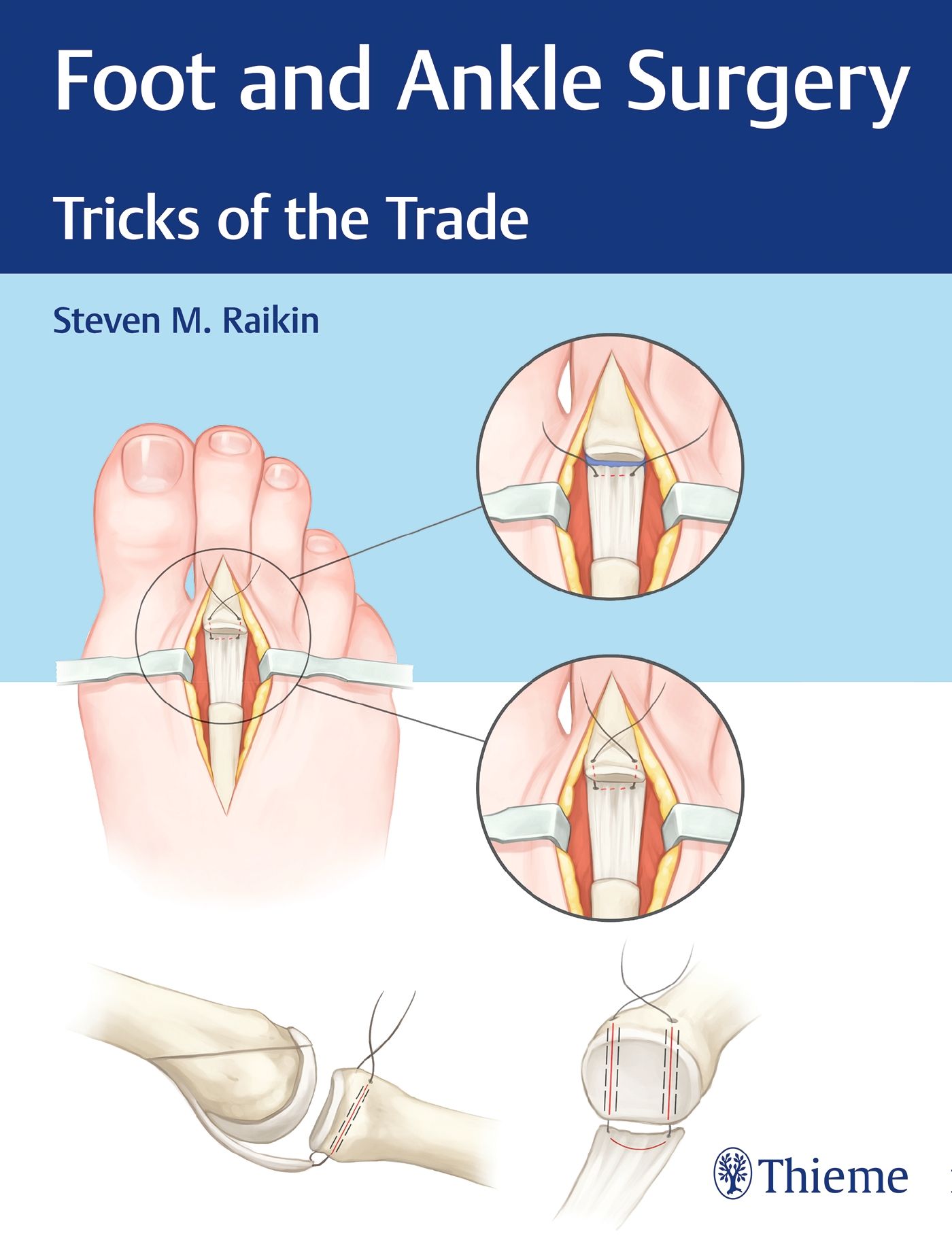 Buchcover: Foot and Ankle Surgery. Titel: Tricks of the Trade. Autor: Steven M. Raikin. Illustrationen von Fuß- und Knöcheloperationen.