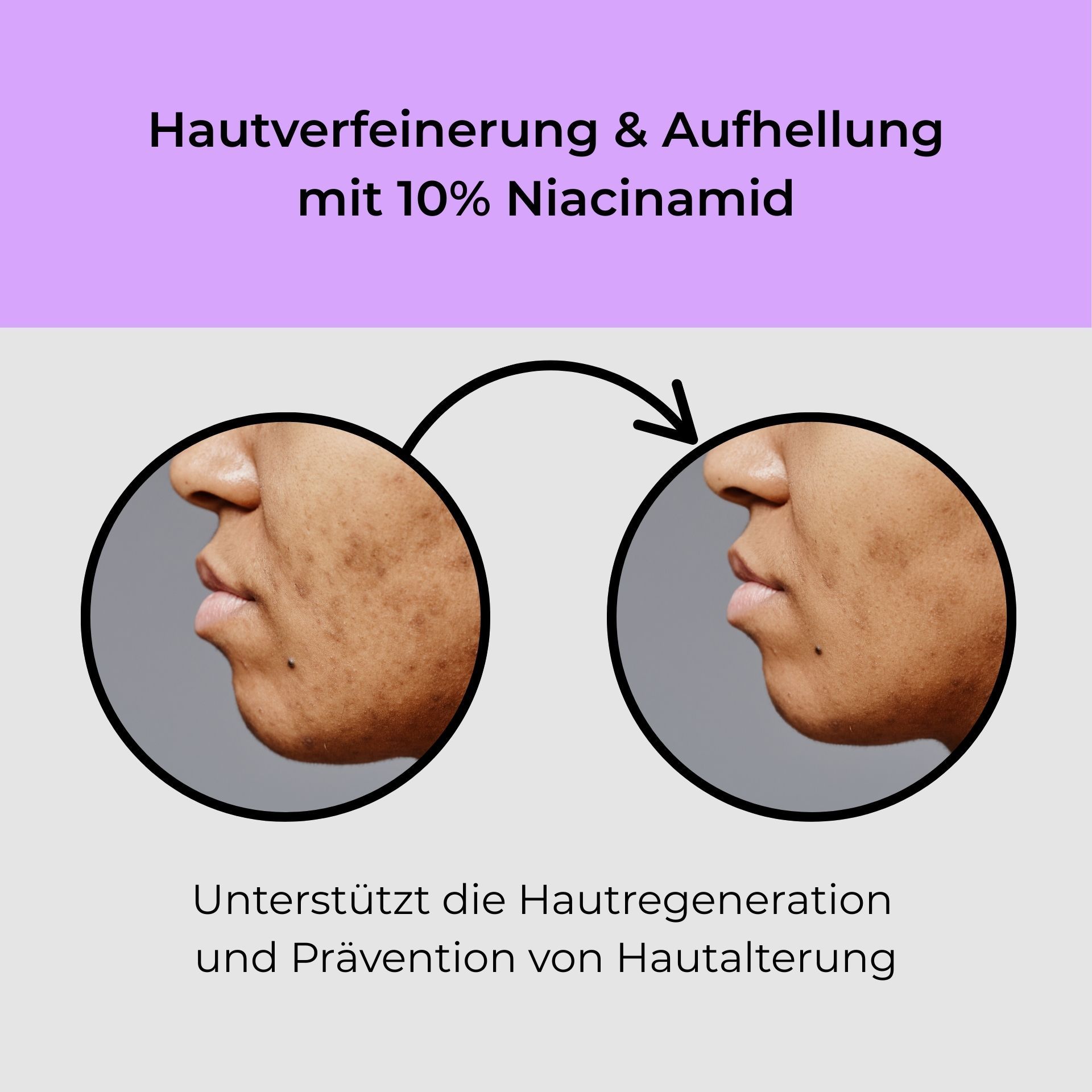 RAU Cosmetics Niacinamide & Astaxanthin Serum Roll-On