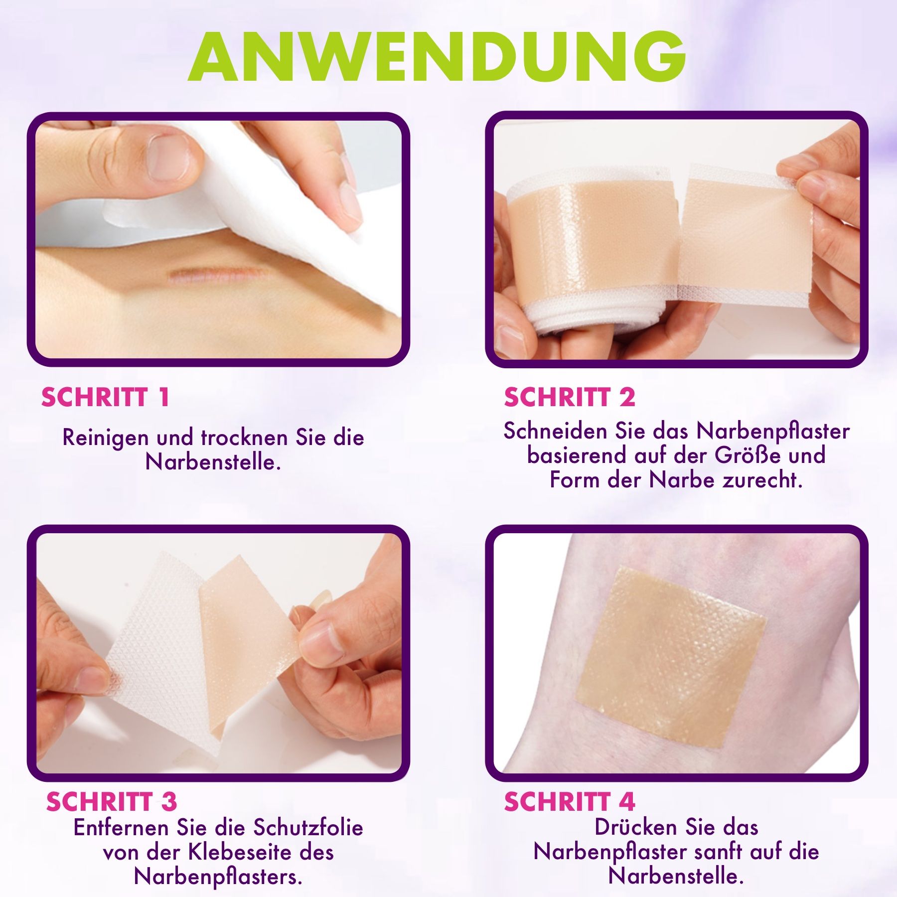 Anwendungsbeispiele: Reinigung, Zuschneiden, Schutzfolie entfernen, Aufkleben des Silikonpflasters auf die Narbe.