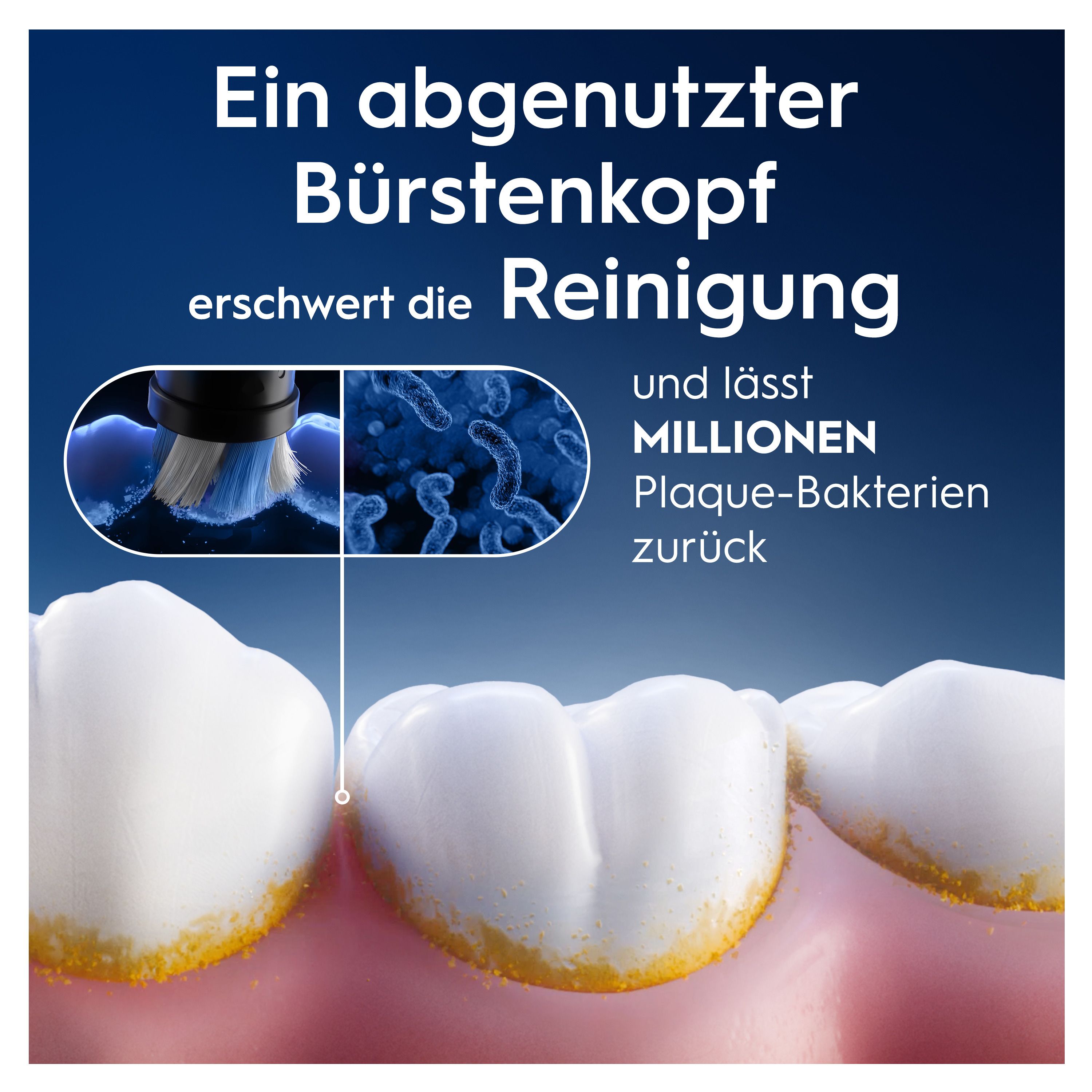 Zahn mit Bakterien und Zahnbürstenkopf. Text: Ein abgenutzter Bürstenkopf erschwert die Reinigung.