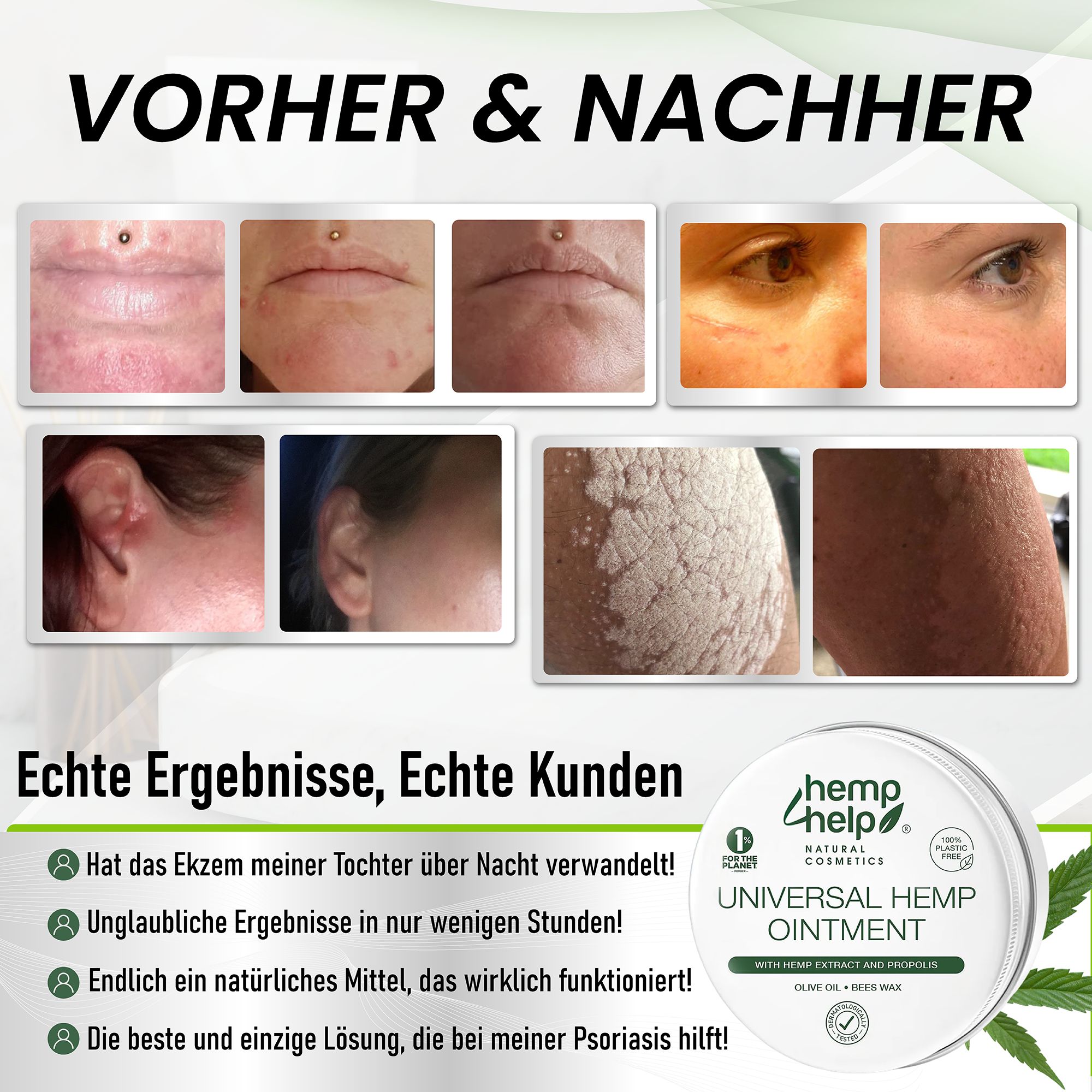 Vorher-Nachher-Bilder zeigen Hautveränderungen. Eine Dose mit "hemp help"-Salbe. Text: Echte Ergebnisse, echte Kunden. Inhaltsstoffe: Hanfextrakt, Olivenöl, Bienenwachs.