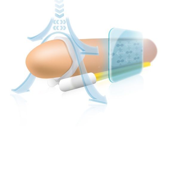 Illustration eines Penis mit einem Gerät. Blaue Pfeile zeigen die Richtung an. Transparente Elemente.