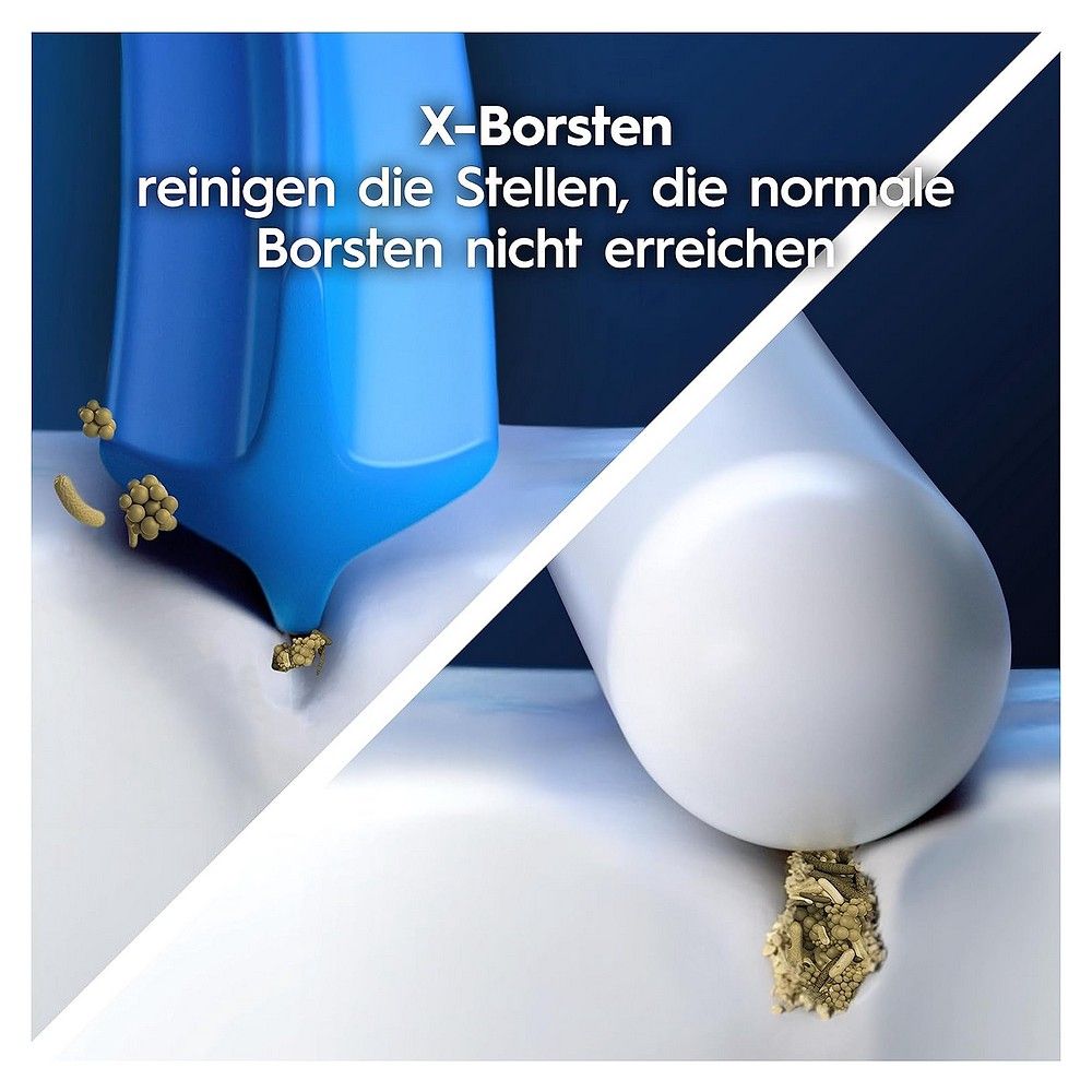 Vergleich von X-Borsten mit normalen Borsten bei der Reinigung von Zahnbelag.