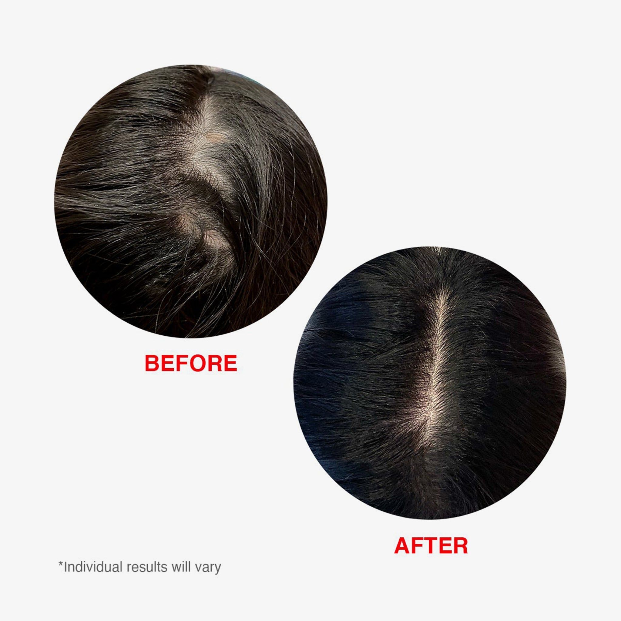 Scalp Serum