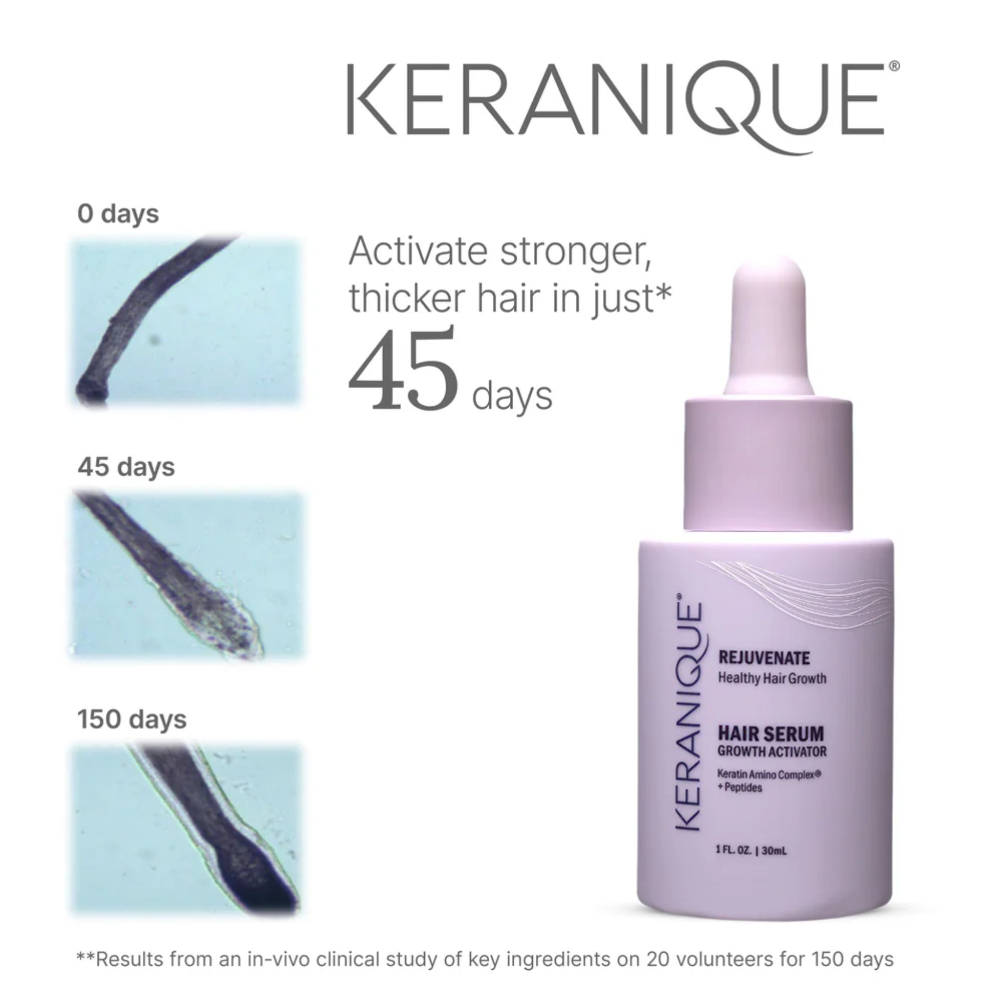 Serumflasche von Keranique. Zeigt Haarveränderungen nach 45 Tagen. Aufschrift: Hair Serum Growth Activator.