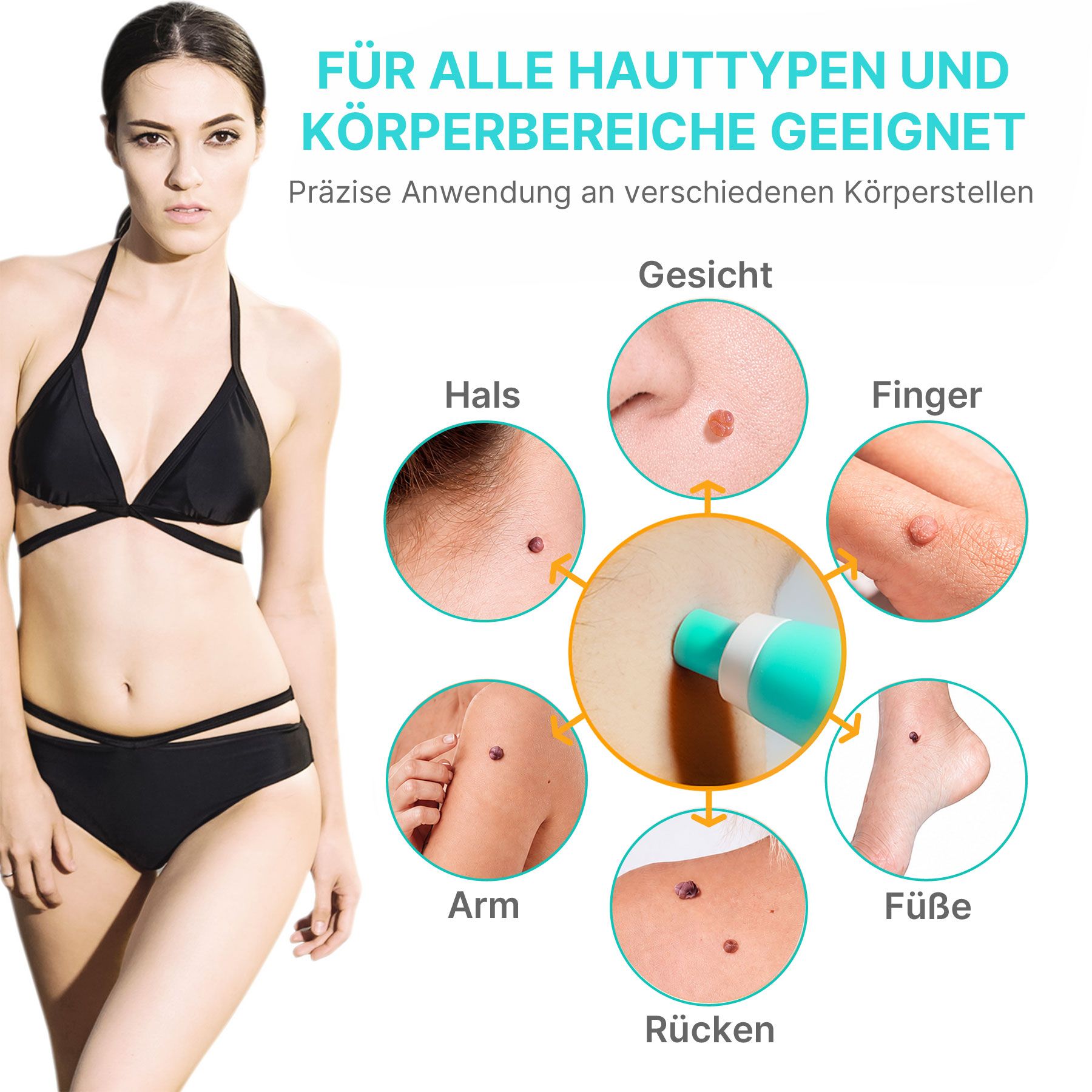 ALIVER Warzen-Behandlungsstift Entferner Skin Tag Removal Set 2in1 Anti Warzenentferner