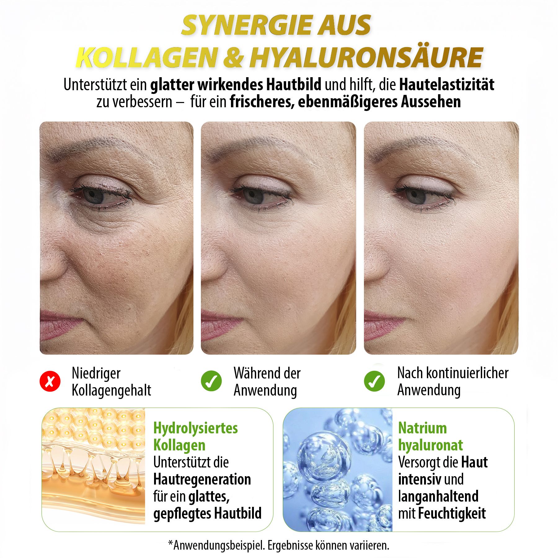Gesichtsfotos. Text: Synergie aus Kollagen & Hyaluronsäure. Vorher/während/nach Anwendung. Hautbild.