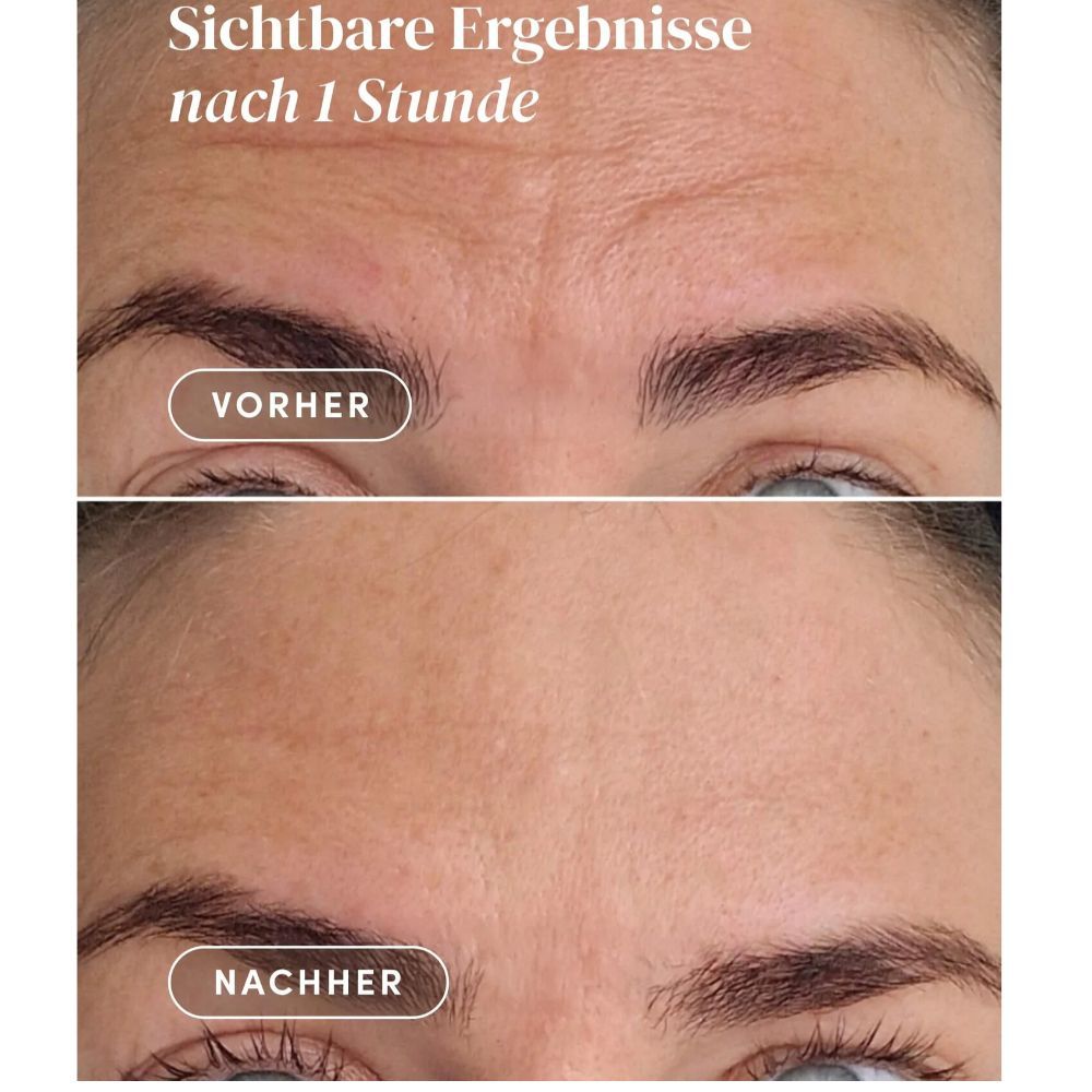 Zwei Bilder zeigen Vorher-Nachher-Effekt. Deutliche Verbesserung der Hautstruktur nach einer Stunde Anwendung.
