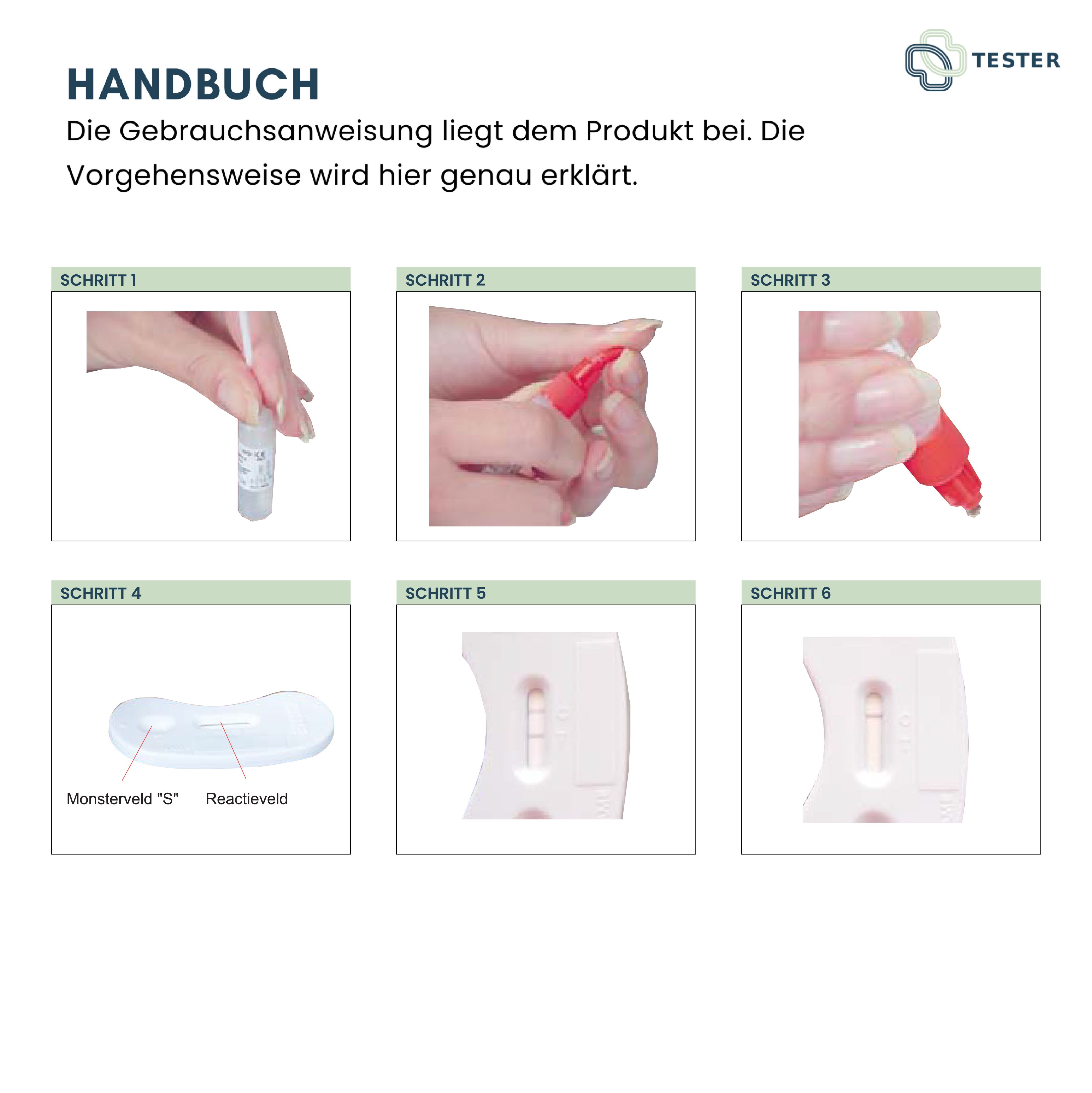 Anleitung zur Durchführung des Chlamydien Selbsttests. Sechs Schritte werden bildlich dargestellt, beginnend mit der Probenentnahme.