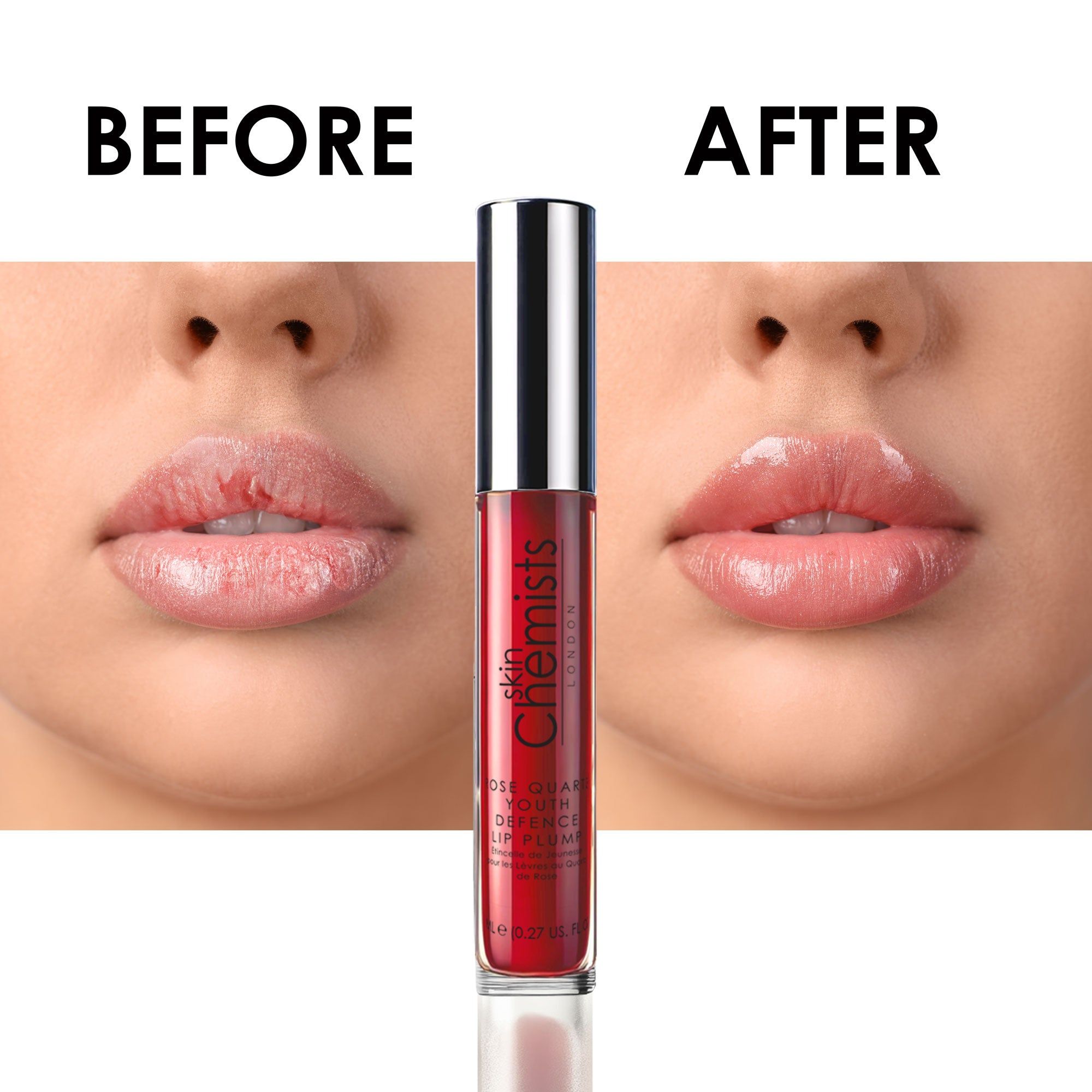 Vorher-Nachher-Vergleich. Lippen vor und nach Anwendung. Darunter: Roter Lip Plump mit silbernem Deckel. Aufschrift: Skin Chemists.