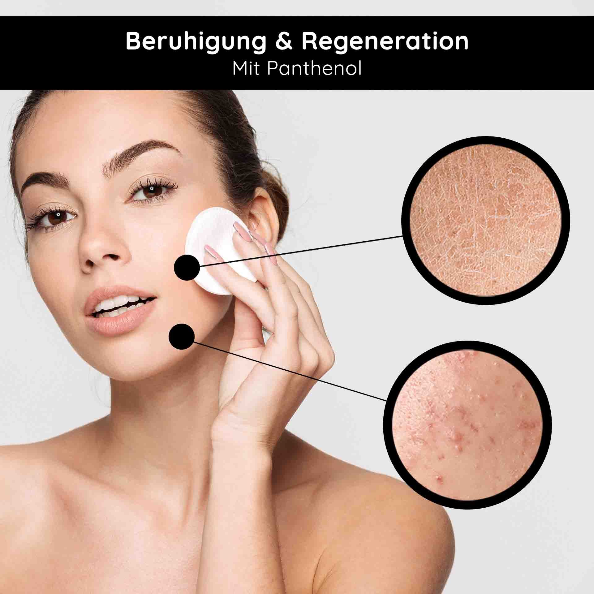 Frau mit Wattepad. Zwei Kreise zeigen Hautunreinheiten. Text: RETINOL SERUM ROLL-ON.