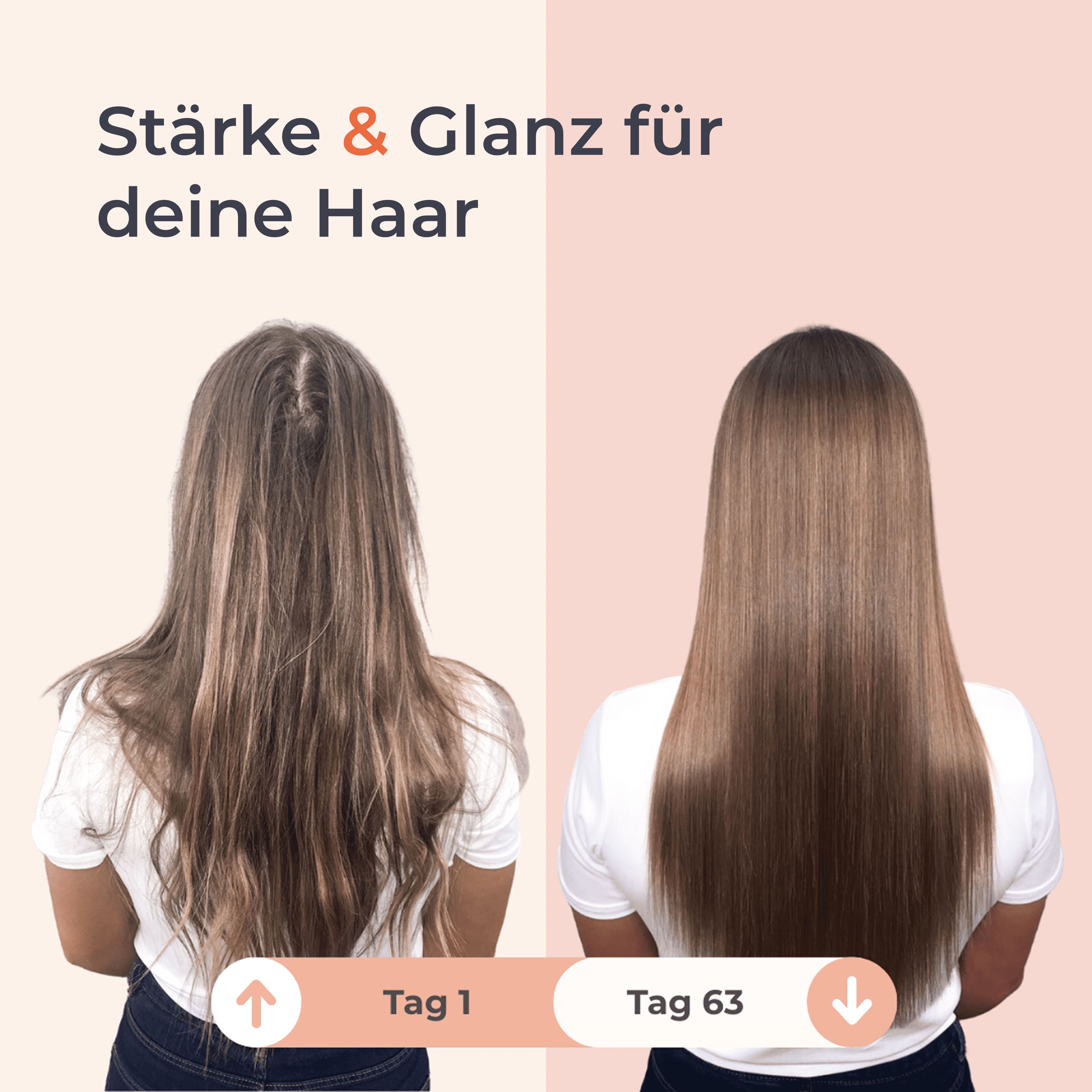 yuicy® Hair Biotin Gummies - Haar-Vitamin Gummibärchen