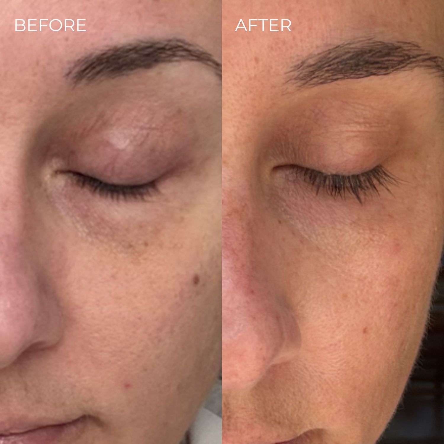 Vorher-Nachher-Vergleich. Augenpartie mit geschlossenen Augen. Nachher: längere Wimpern.