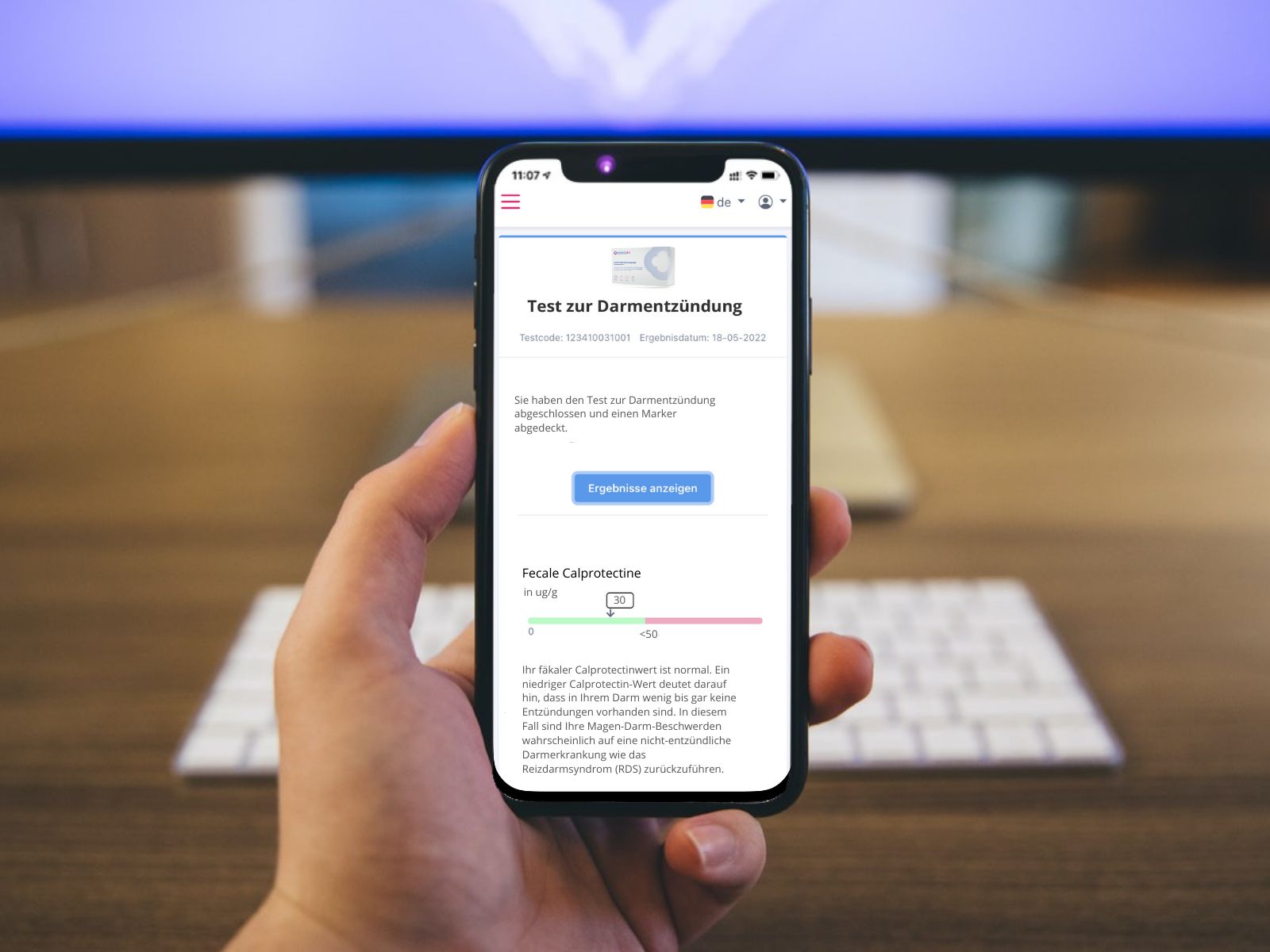 Smartphone mit Test zur Darmentzündung-App. Anzeige: Ergebnis, Fäkal-Calprotectin, Balkendiagramm. Hand hält Telefon vor Tastatur.