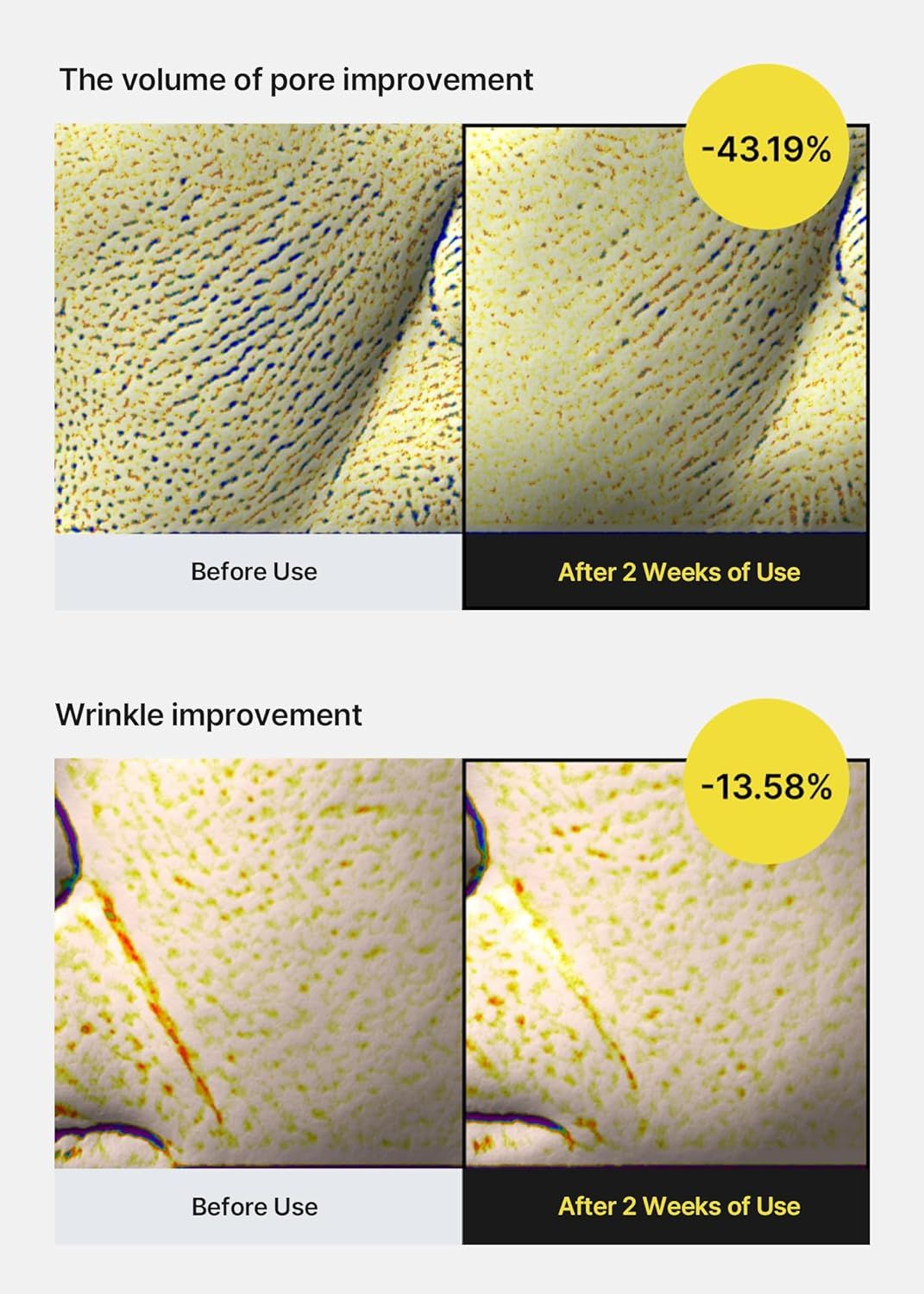 Zwei vergleichende Bilder. Oben: Poren vor und nach 2 Wochen. Unten: Falten vor und nach 2 Wochen. Prozentangaben.