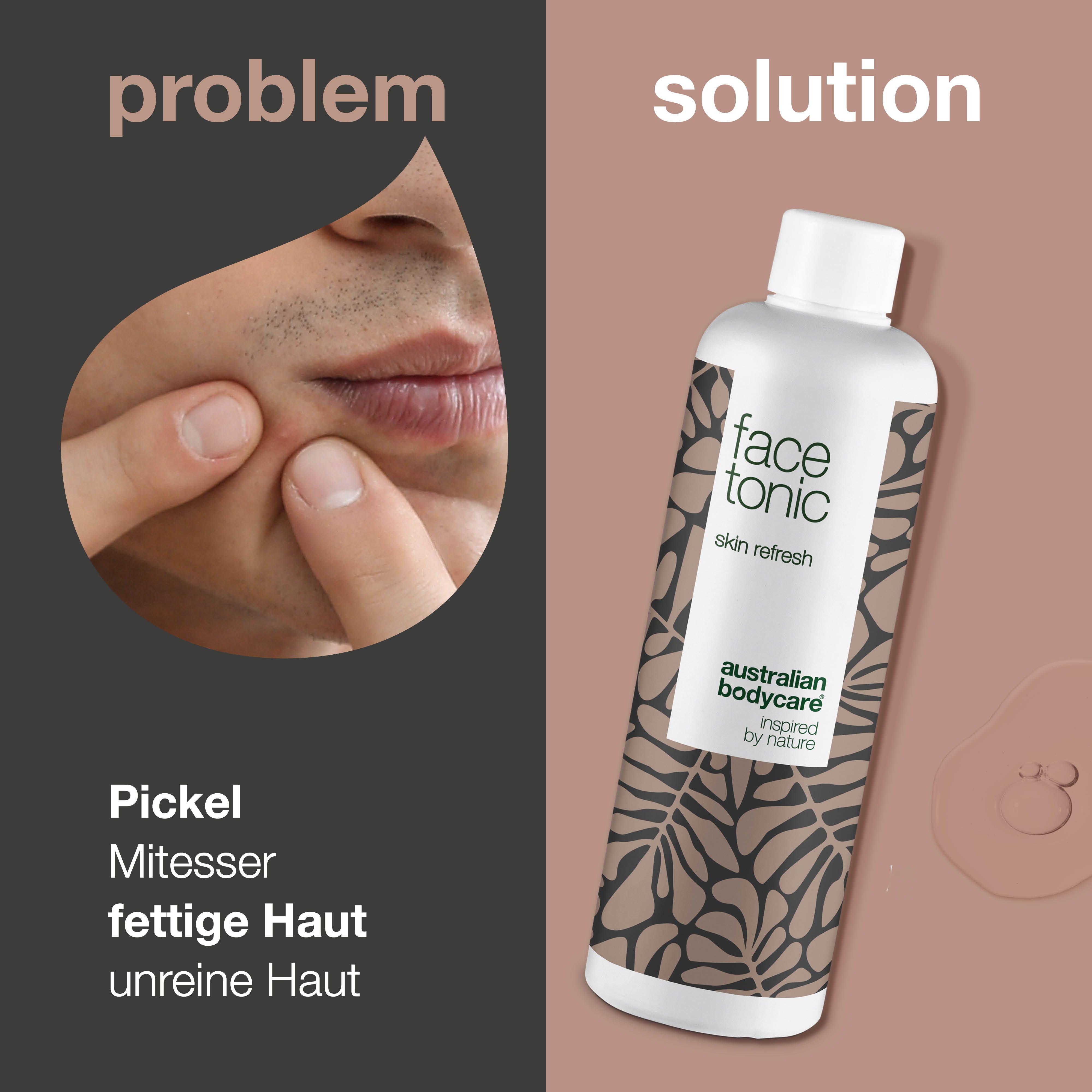 Gesicht mit Pickel. Rechts: Flasche „face tonic“ von Australian Bodycare. Text: Pickel, Mitesser, fettige Haut, unreine Haut.