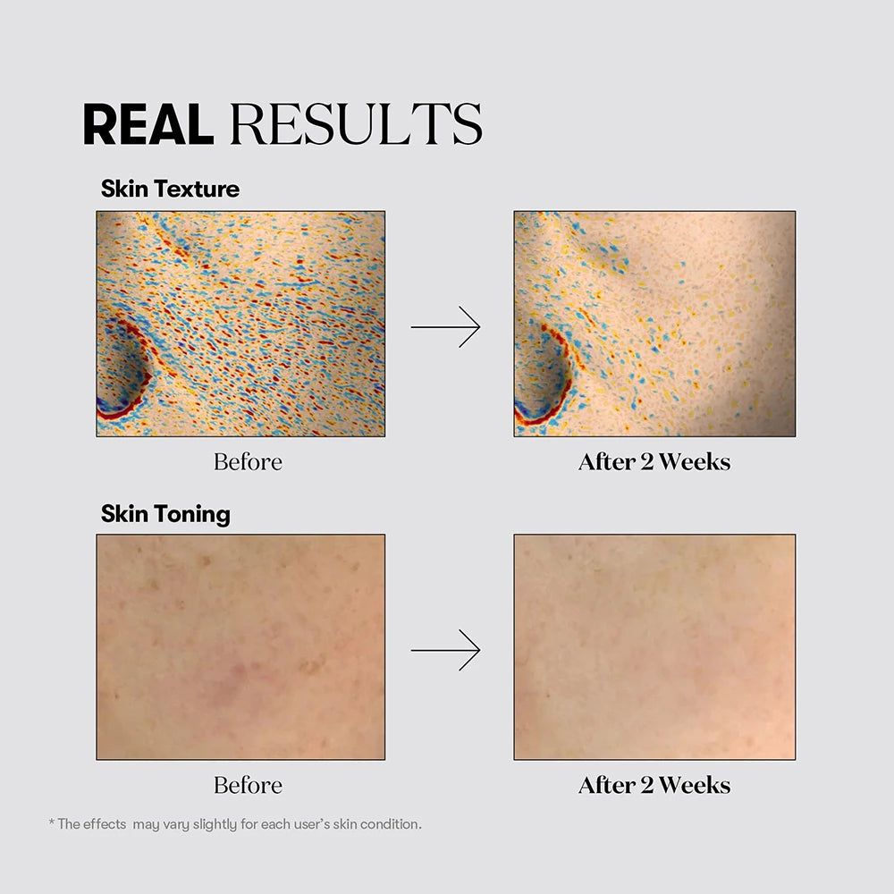 VT COSMETICS TX-Toning Essenz 1000 Shot