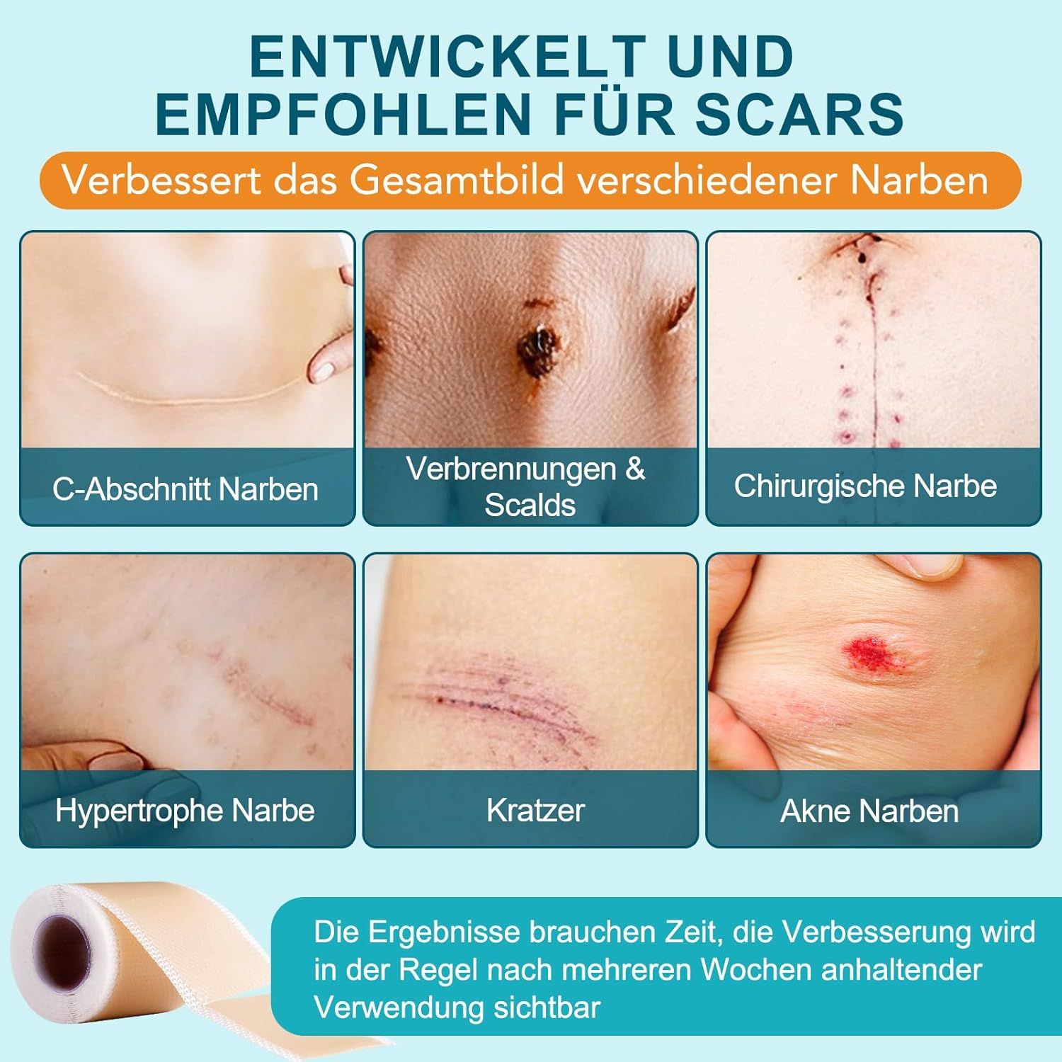 Beispiele für Narben: Kaiserschnitt, Verbrennungen, chirurgische Narbe, hypertrophe Narbe, Kratzer, Akne Narben. Rolle Narbenpflaster.
