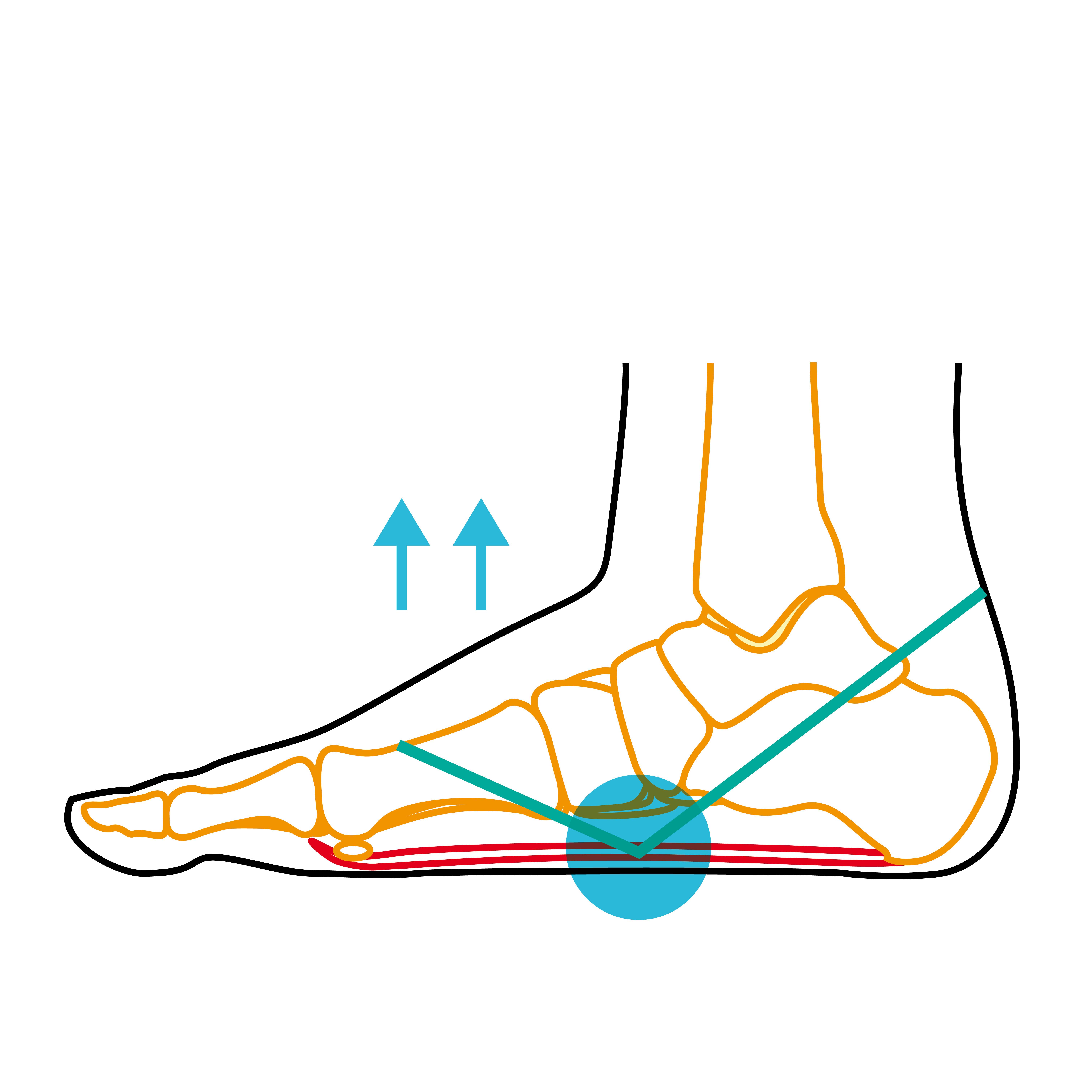 Schematische Darstellung eines Fußes mit Markierungen für Sehnen und Knochen. Blaue Markierung am Fußgewölbe, Pfeile nach oben.