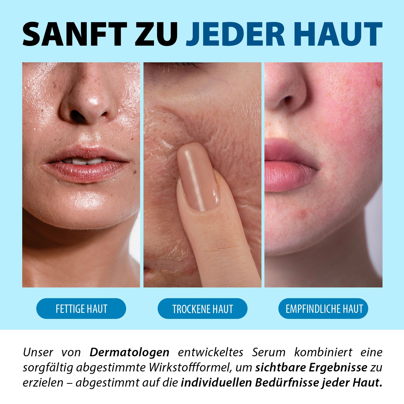 Drei Hauttypen: fettige, trockene und empfindliche Haut. Text: Sanft zu jeder Haut. Dermatologisch getestetes Serum für sichtbare Ergebnisse.