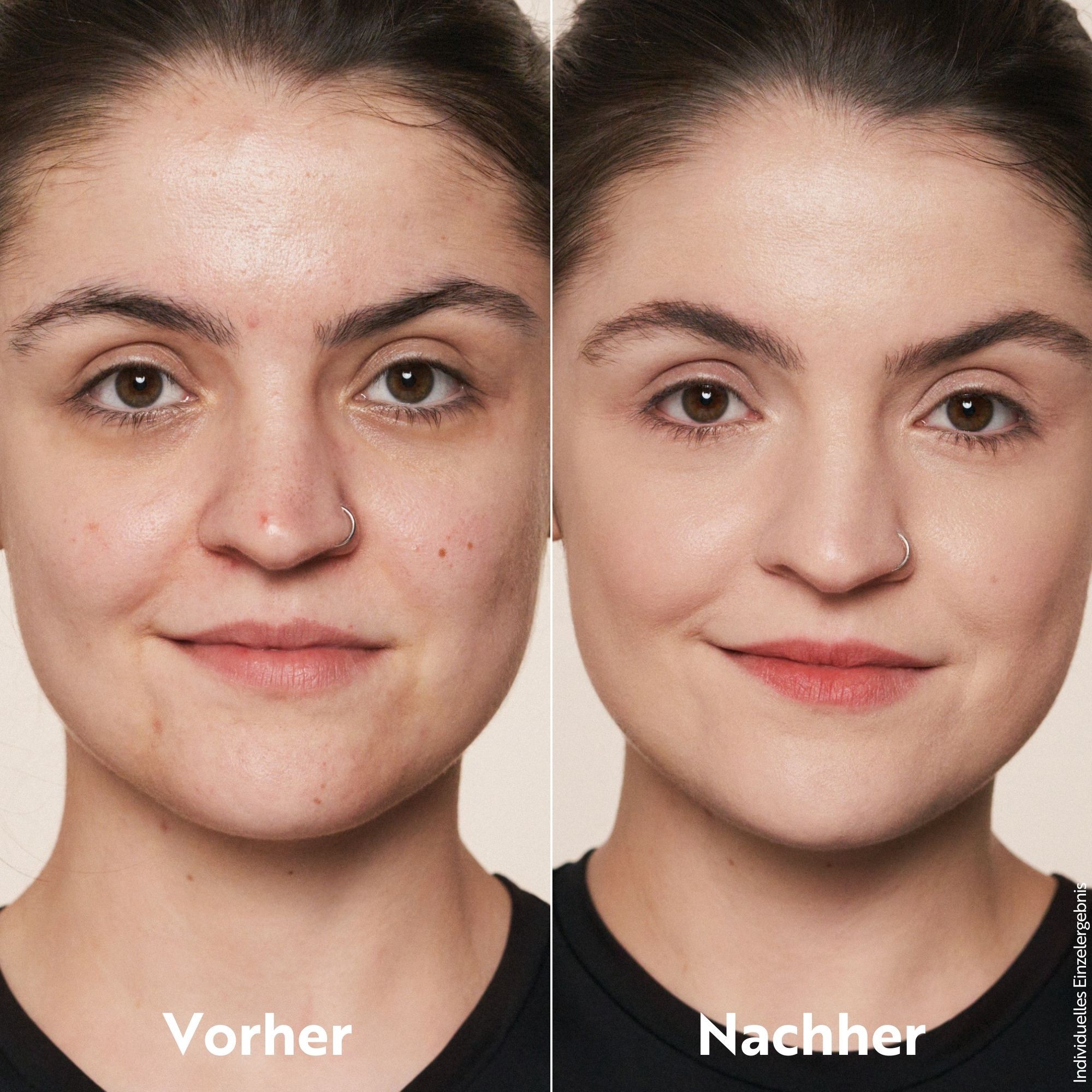 Vorher-Nachher-Vergleich. Gesicht einer Frau vor und nach dem Auftragen von Make-up. Deutliche Verbesserung des Hautbildes.