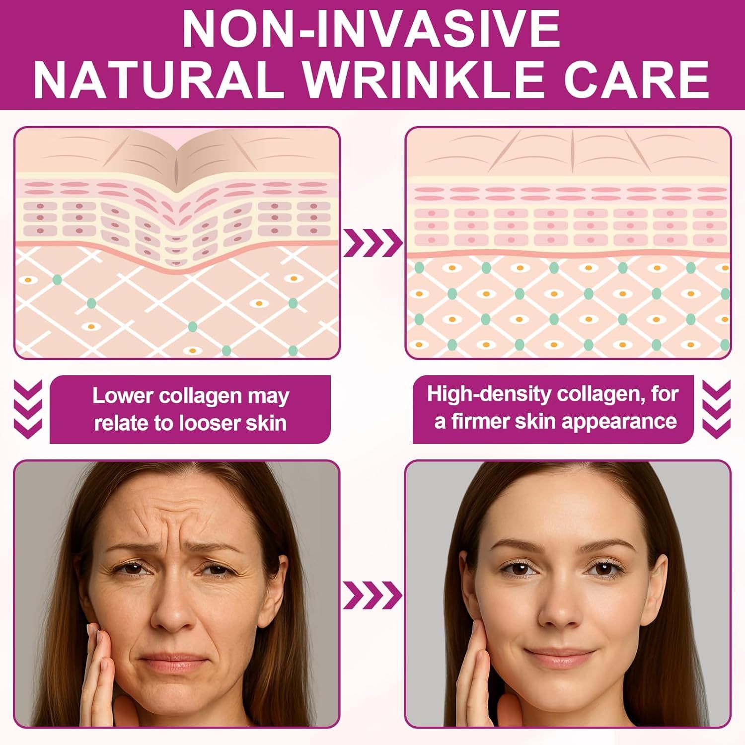 Abodiuss Wrinkle Patches für Gesicht