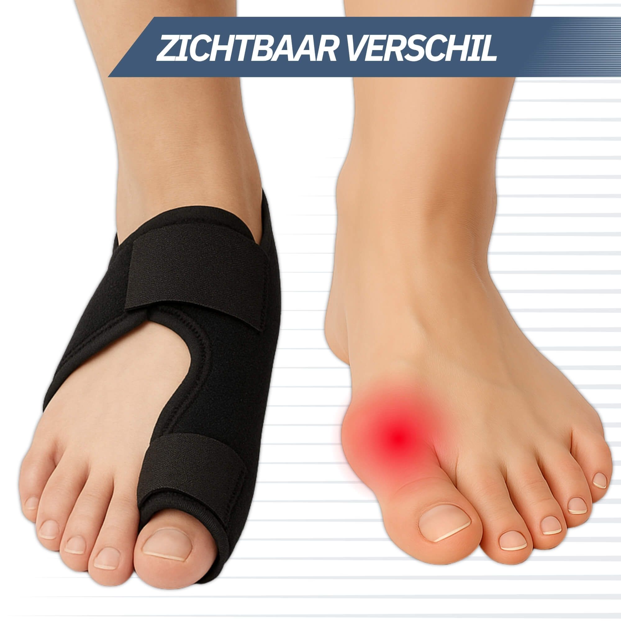Vergleich: Fuß mit und ohne Hallux-Valgus-Schiene. Roter Punkt markiert Schmerzbereich.