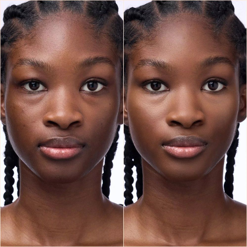 Zwei Gesichter einer Person. Links: Hautunreinheiten. Rechts: Glatte Haut. Beide Gesichter sind identisch.