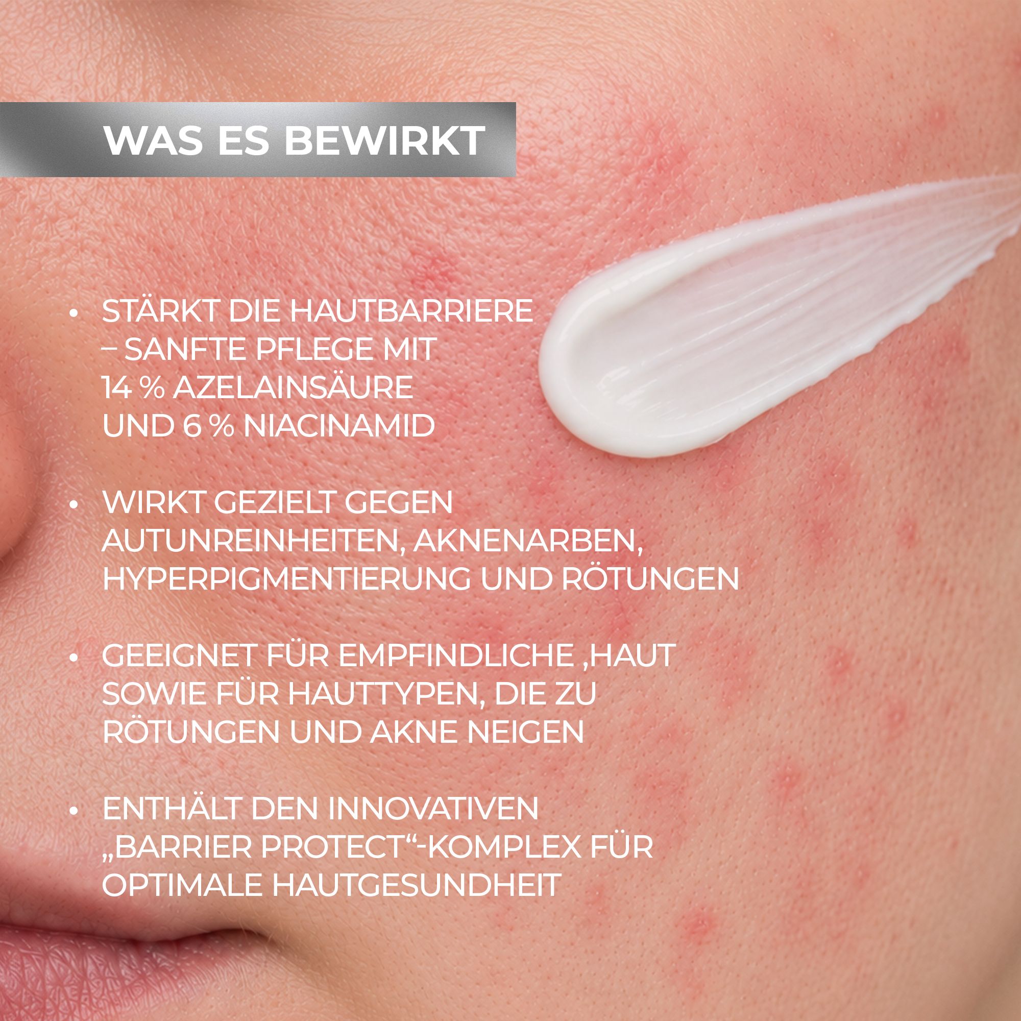 Biotrade AzeB3 Barrier Protect Intensivpflegecreme mit Azelainsäure 14% und Niacinamid 6%