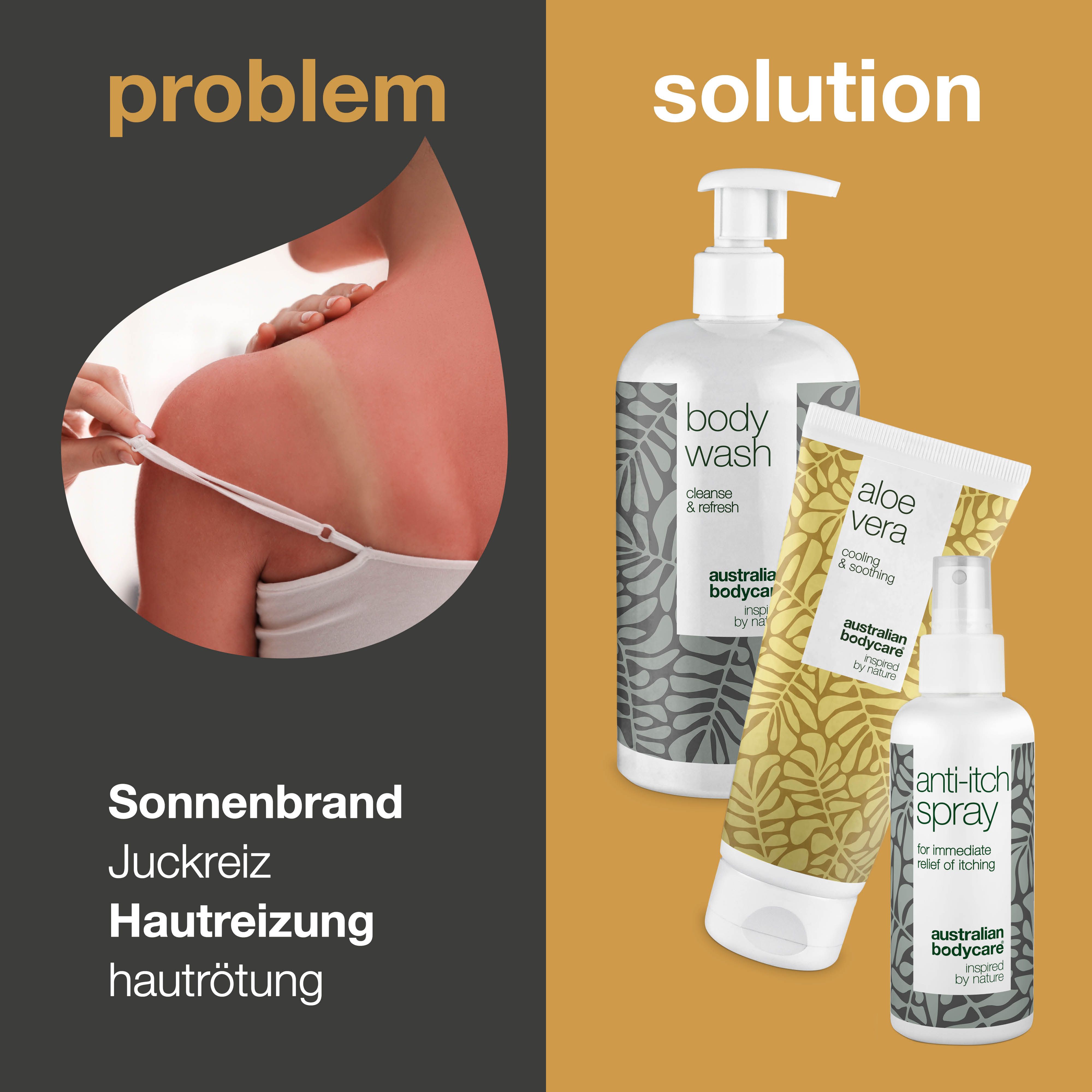 Sonnenbrand-Problem und Lösung. Rechts: Body Wash, Aloe Vera Gel und Anti-Juckreiz Spray.