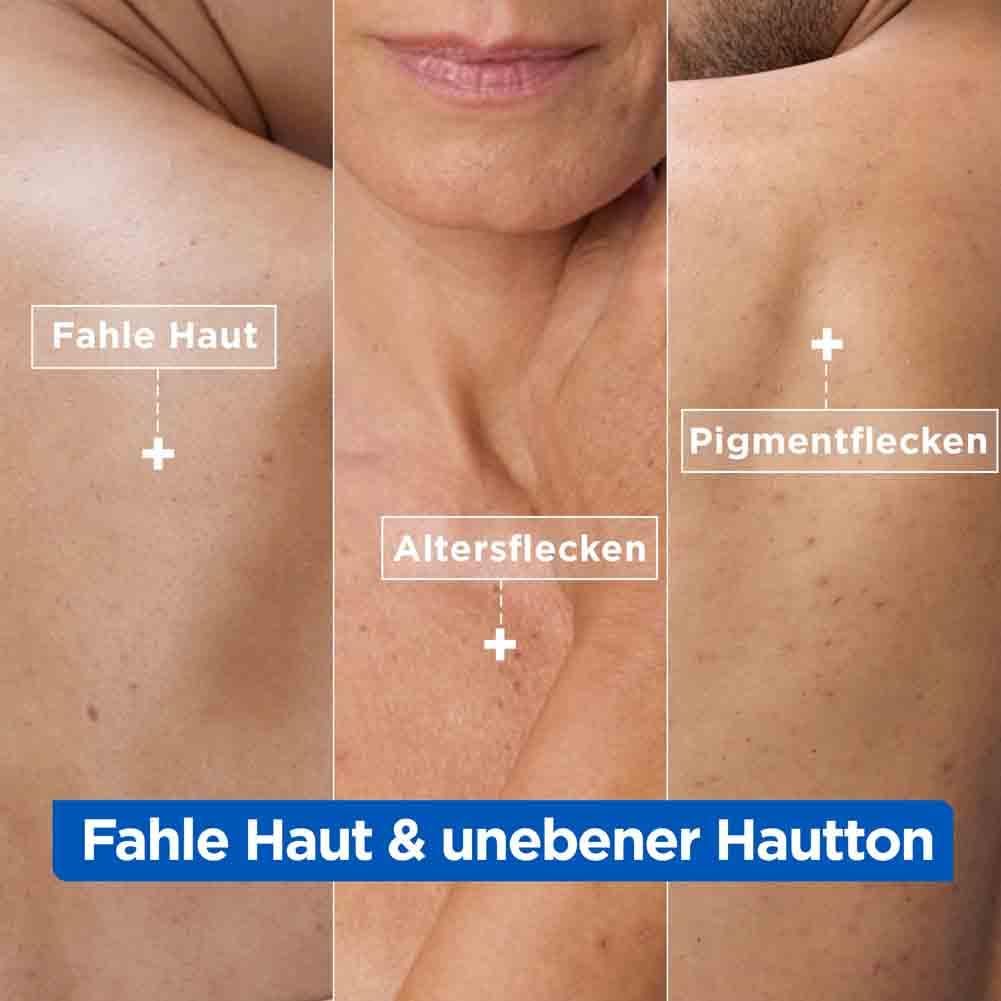 Drei Hautausschnitte zeigen: Fahle Haut, Altersflecken, Pigmentflecken. Text: Fahle Haut & unebener Hautton.