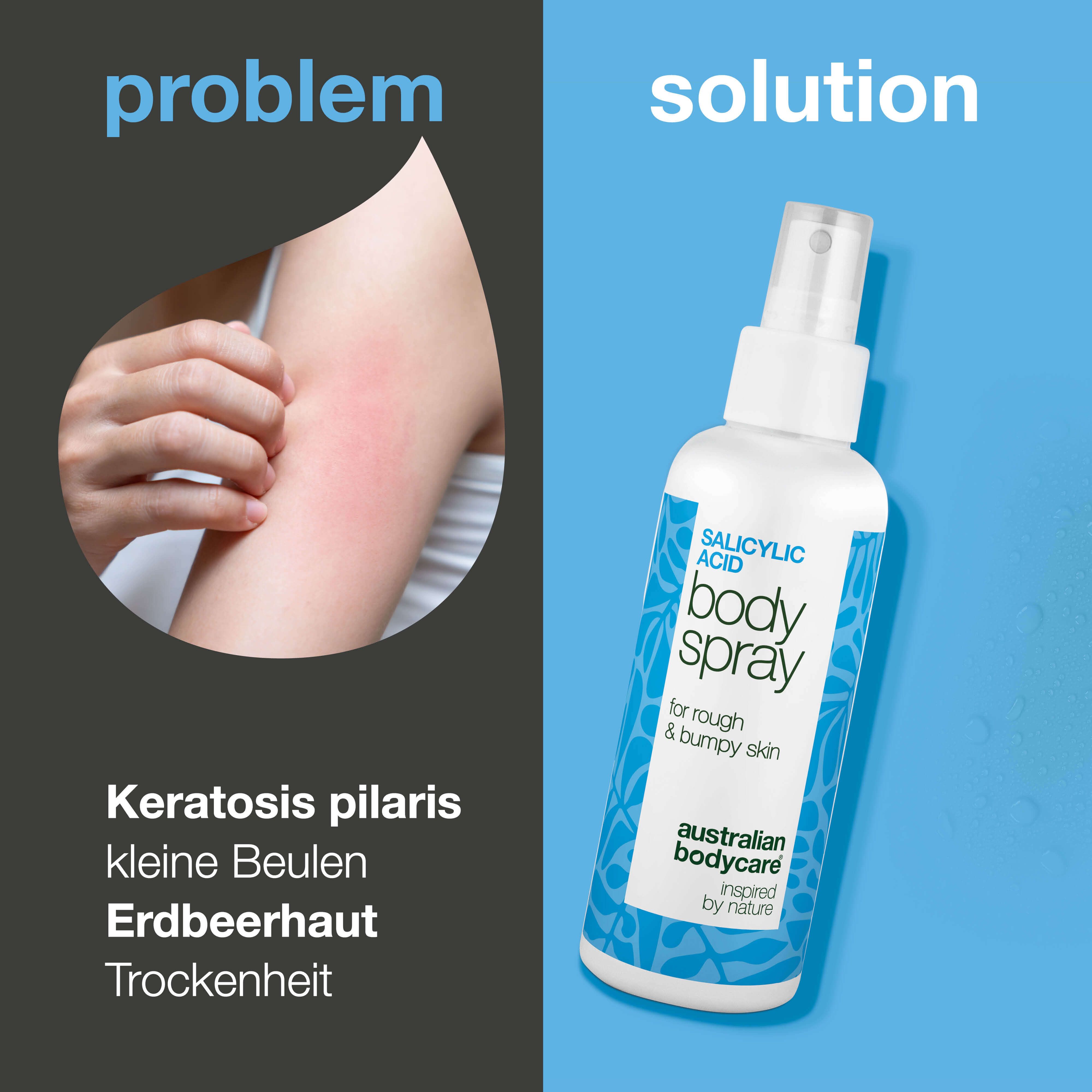Produkt und Arm mit Hautausschlag. Text: Keratosis pilaris, kleine Beulen, Erdbeerhaut, Trockenheit.