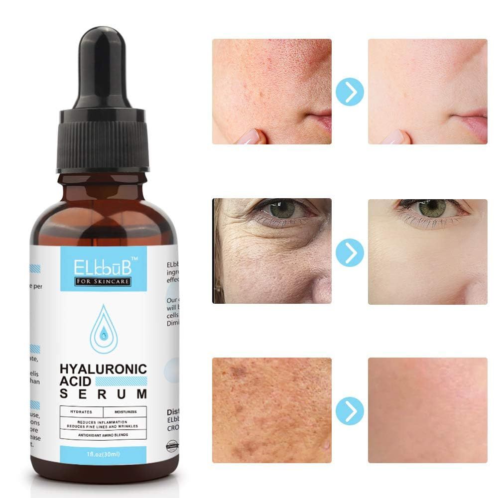 Hyaluronsäure Serum - Anti Aging Hyaluron Serum Pflege Konzentrat - Schnell einziehend