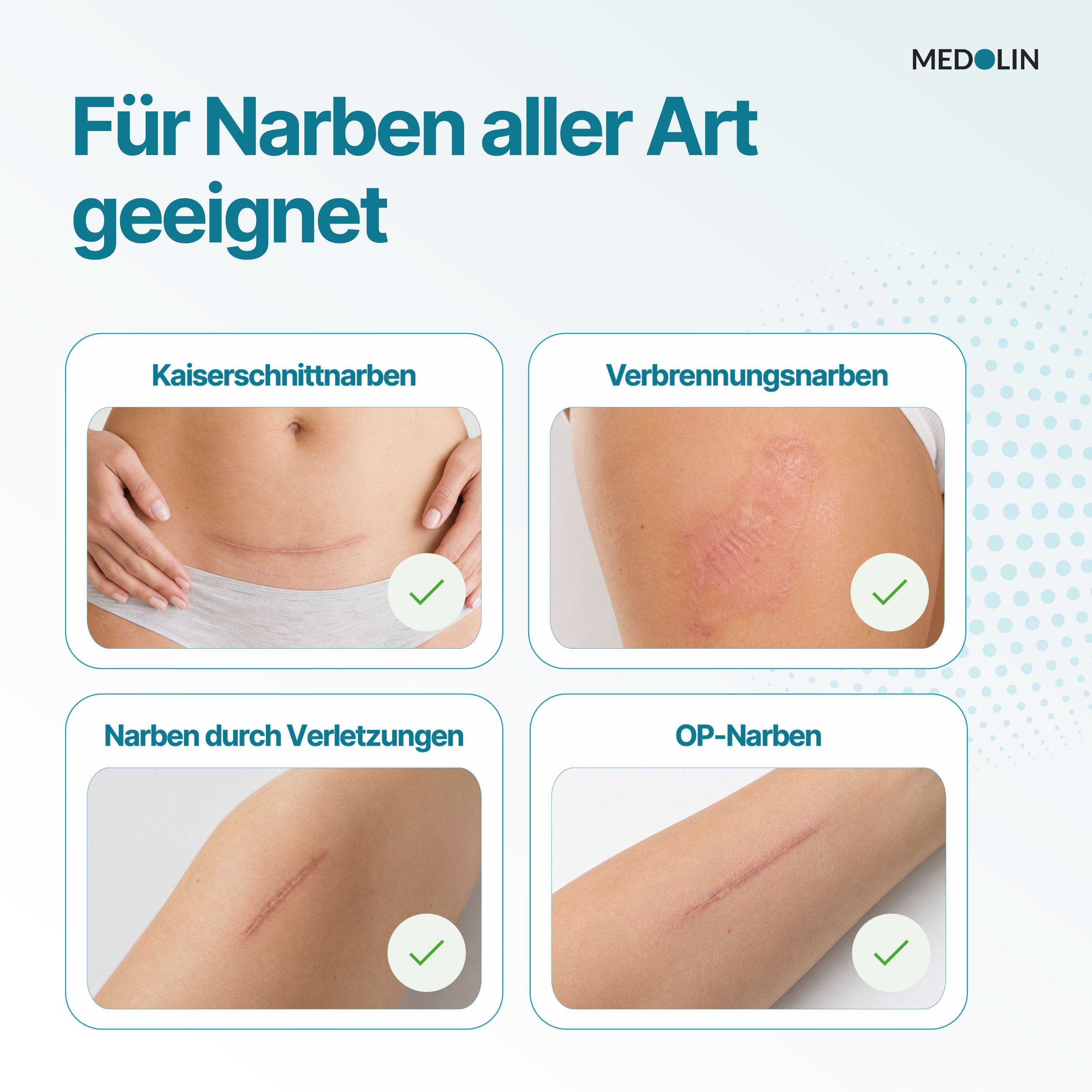 Vier Beispiele für Narben: Kaiserschnitt, Verbrennung, Verletzung, OP-Narbe. "Für Narben aller Art geeignet" ist zu lesen.