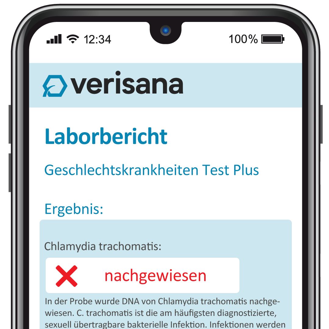 Verisana Geschlechtskrankheiten Test Plus für Männer